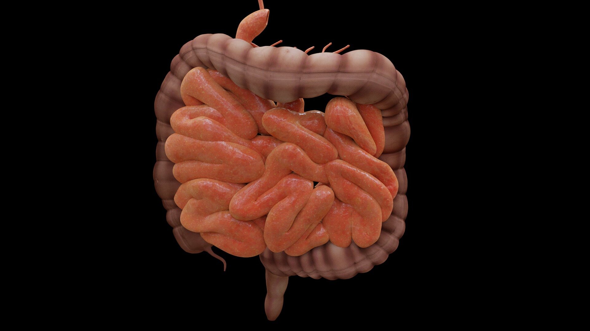 Researchers find dietary interventions may prevent inflammatory symptoms associated with Hirschsprung disease