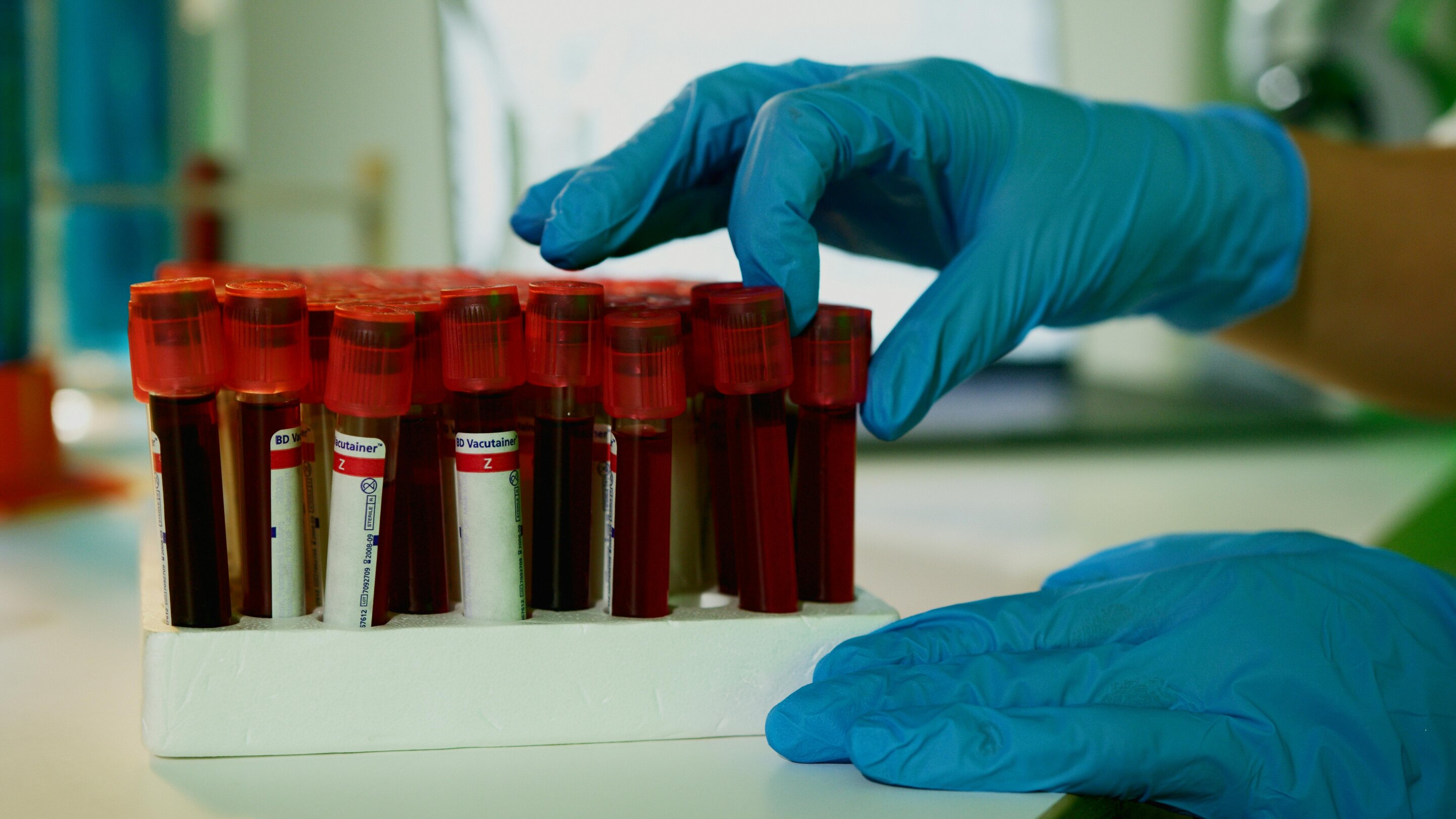 PATHFINDER 2 findings advance multi-cancer early detection blood testing