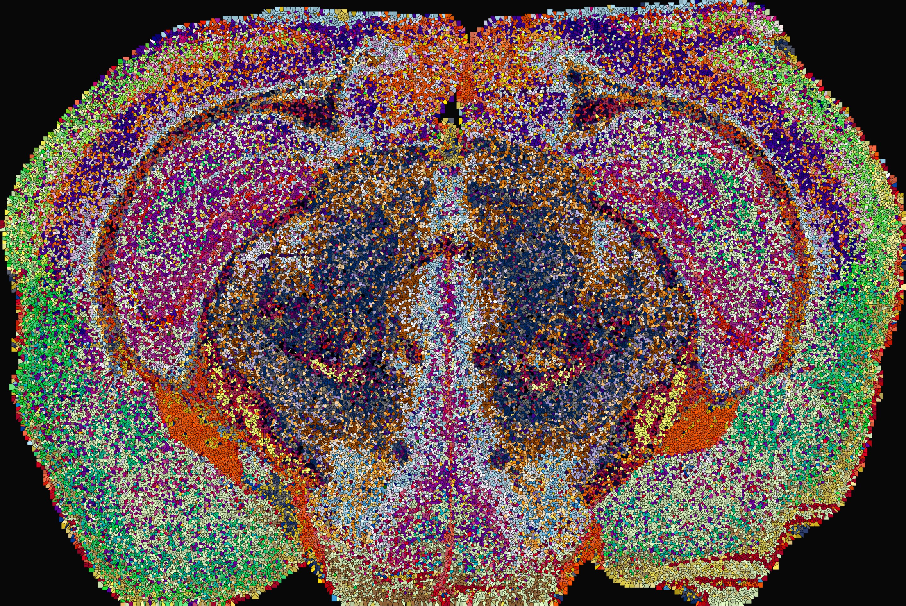 First map of mouse brain lipids reveals over 500 biochemical zones