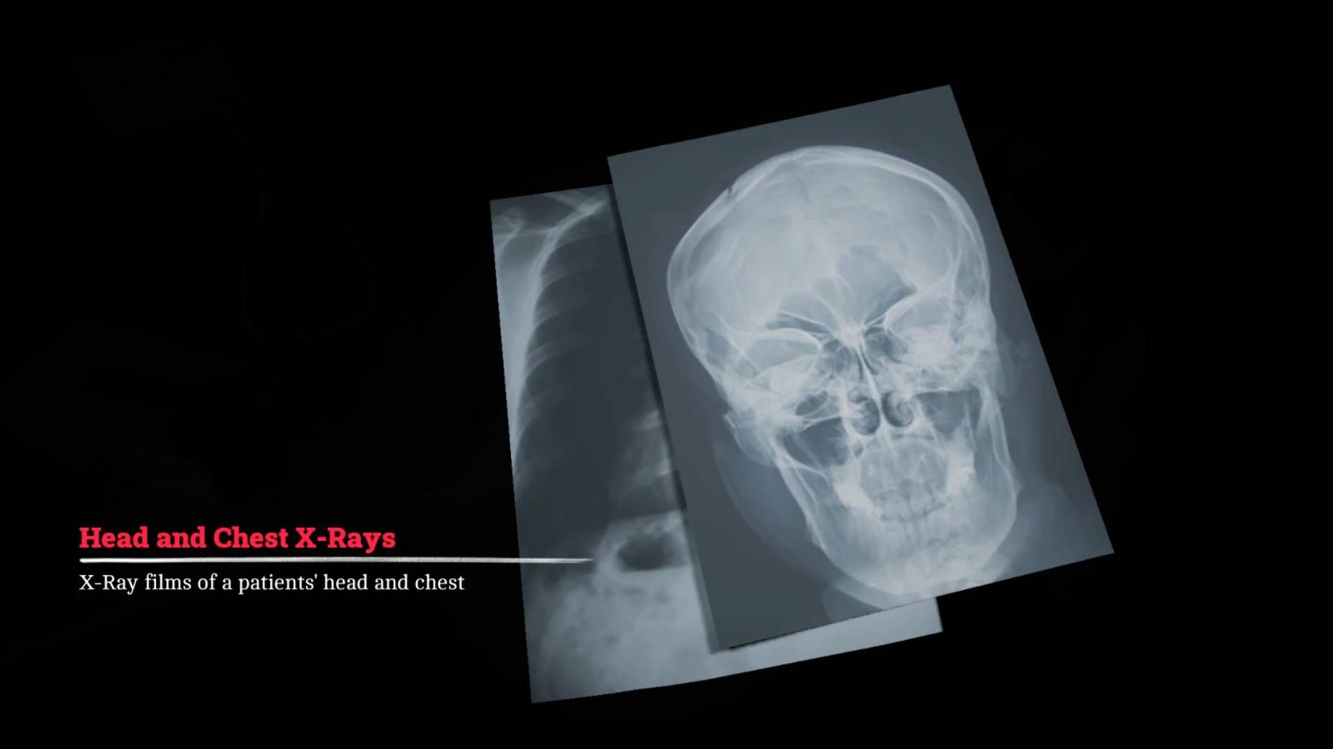How to take the X-Rays in Silent Hill Townfall