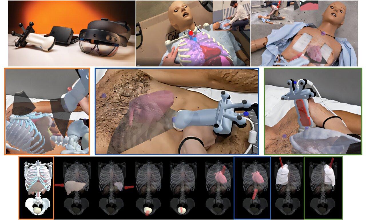 Predictive anatomical guidance system helps novice users acquire trauma ultrasound images