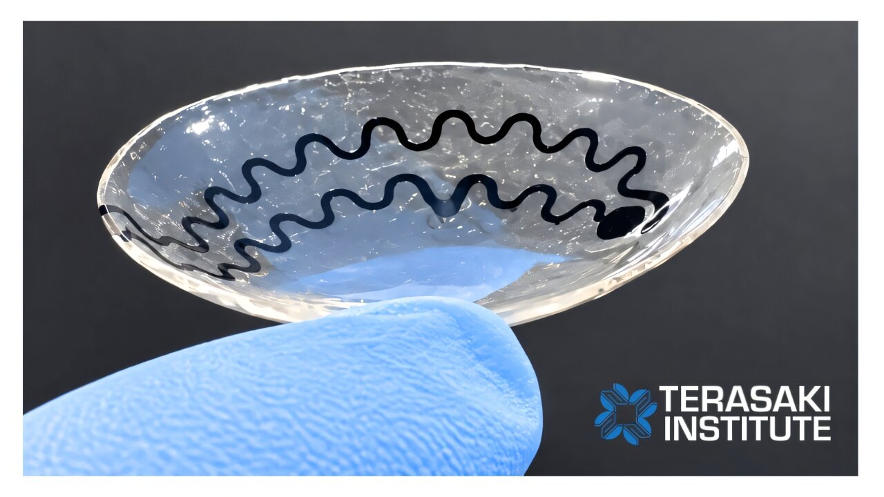 Smart contact lens detects serotonin changes in tear samples collected during stress test