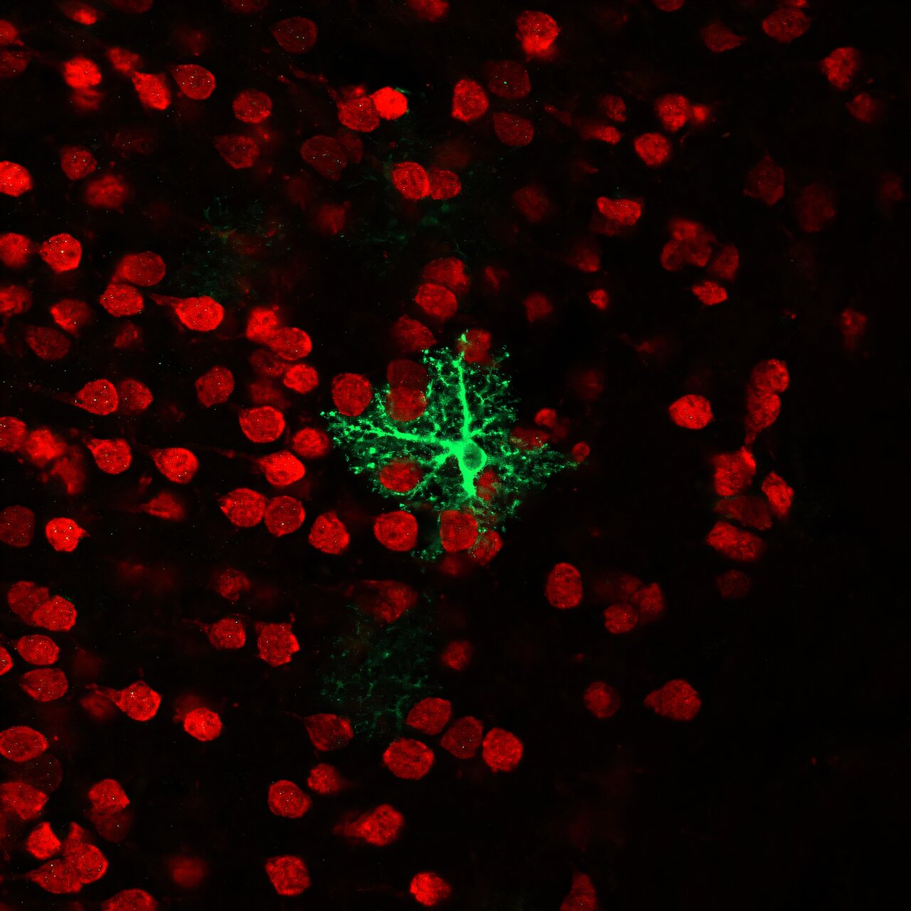 Astrocytes could help track the timing of frightening experiences
