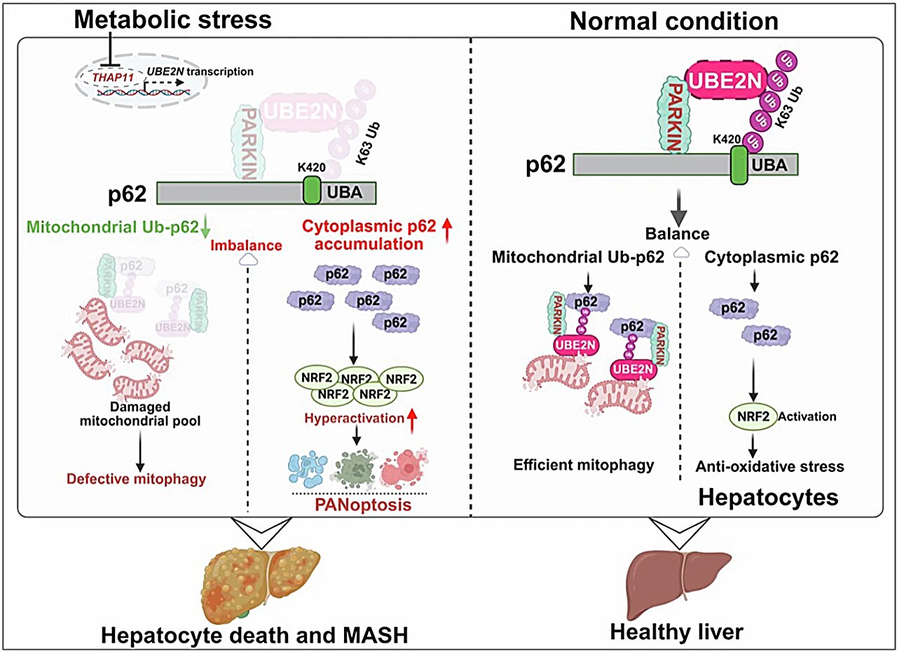 Restoring enzyme involved in cellular cleanup could reduce inflammation and scarring from liver disease MASH