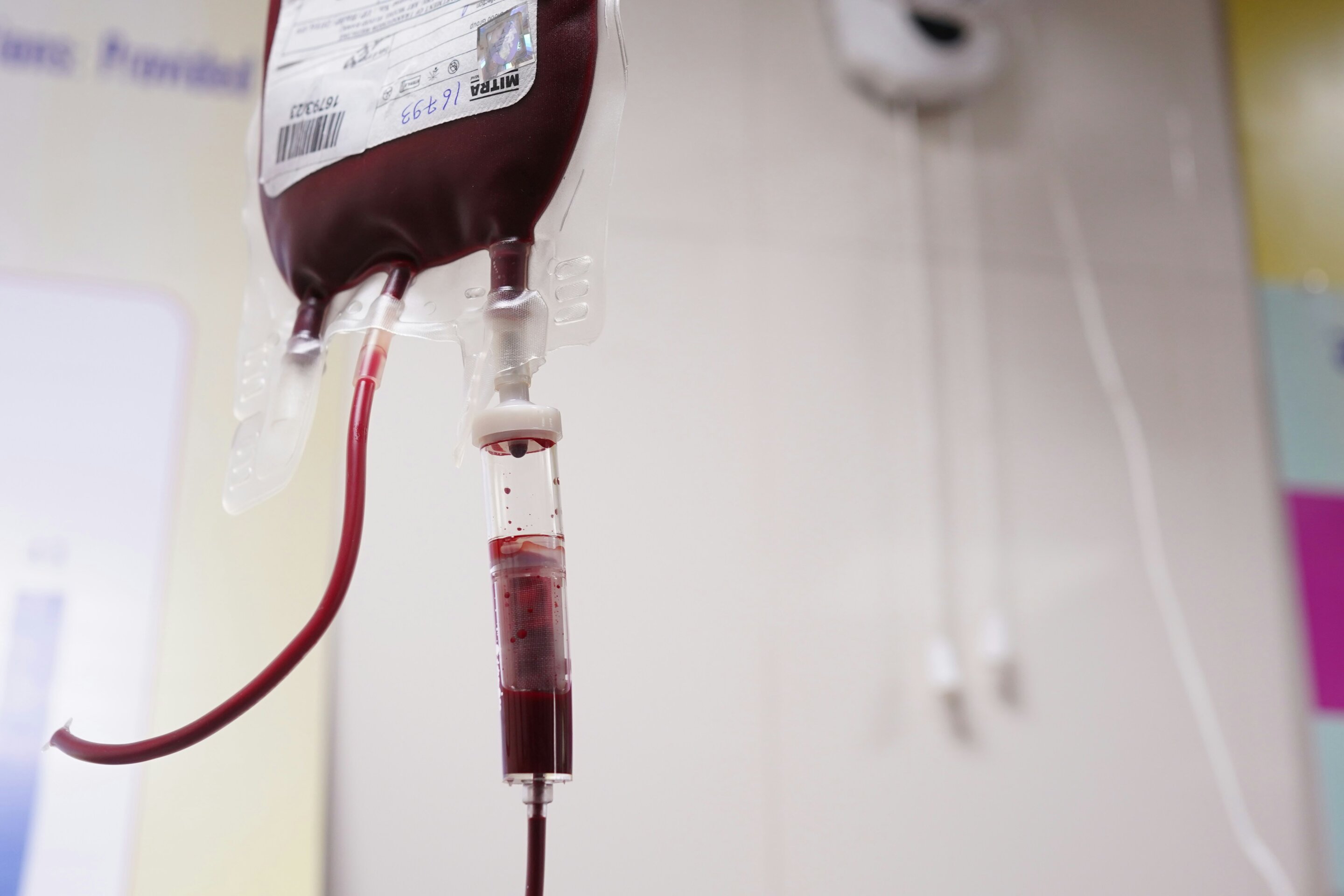 Earlier stem cell transplants may improve survival in rare inherited bone marrow disorder