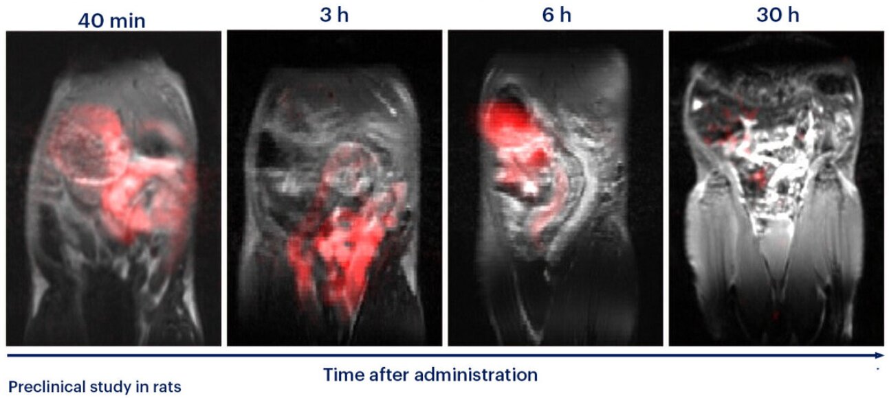 New polymer could enable gastrointestinal transit monitoring without ionizing radiation
