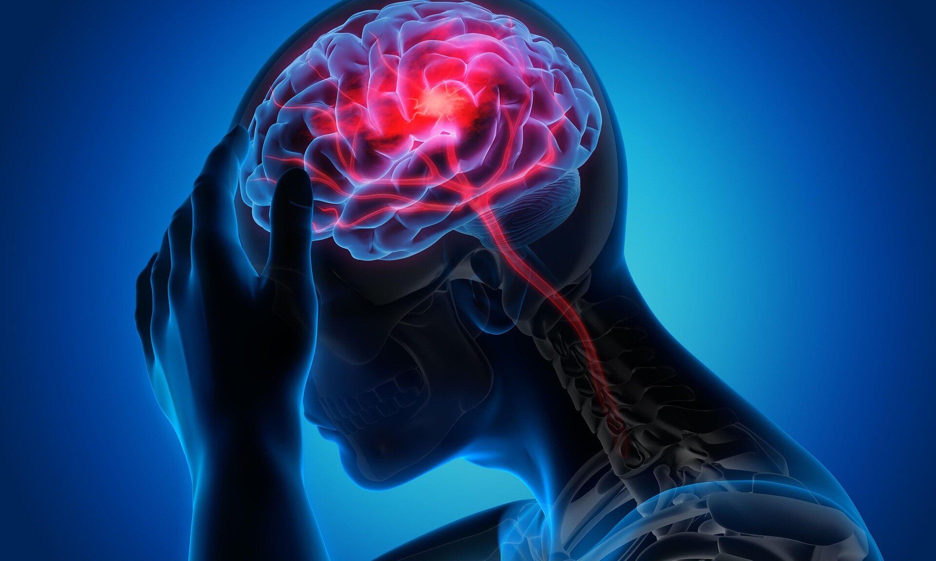 Anti-epileptic drug may reduce migraine aura