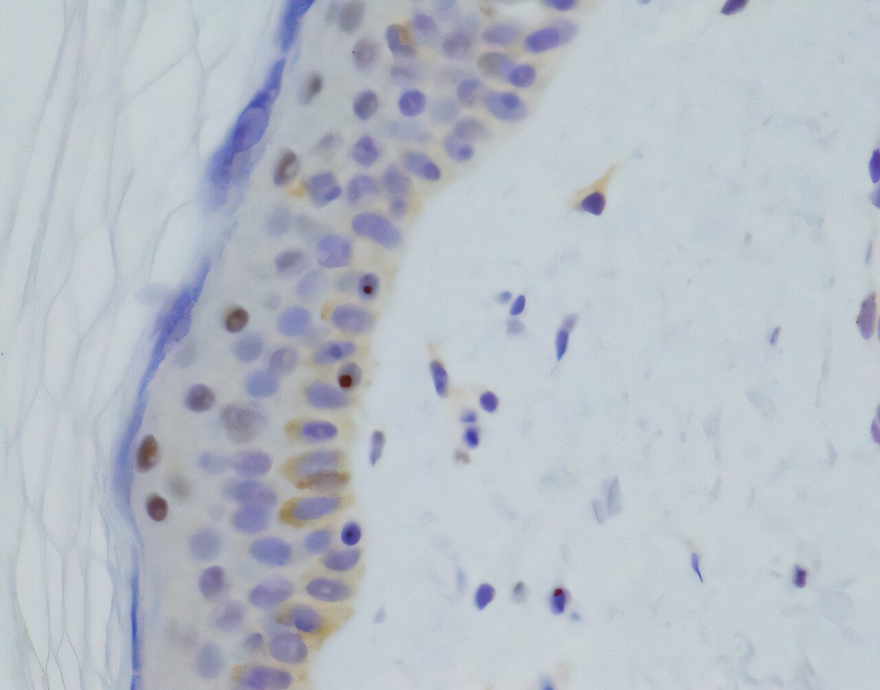 DNA sequencing test finds answers for patients with inherited muscle disease