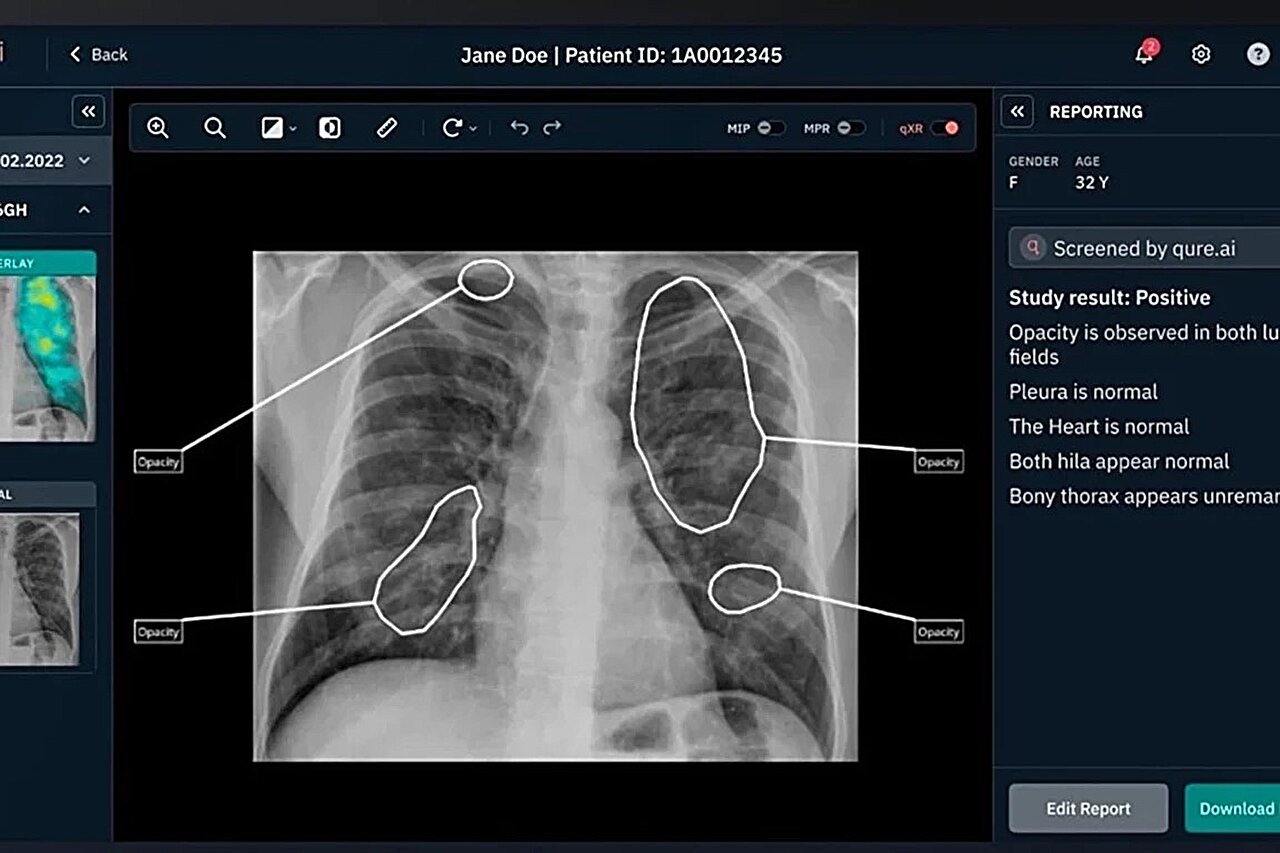 Investigating the cost-effectiveness of AI in public health