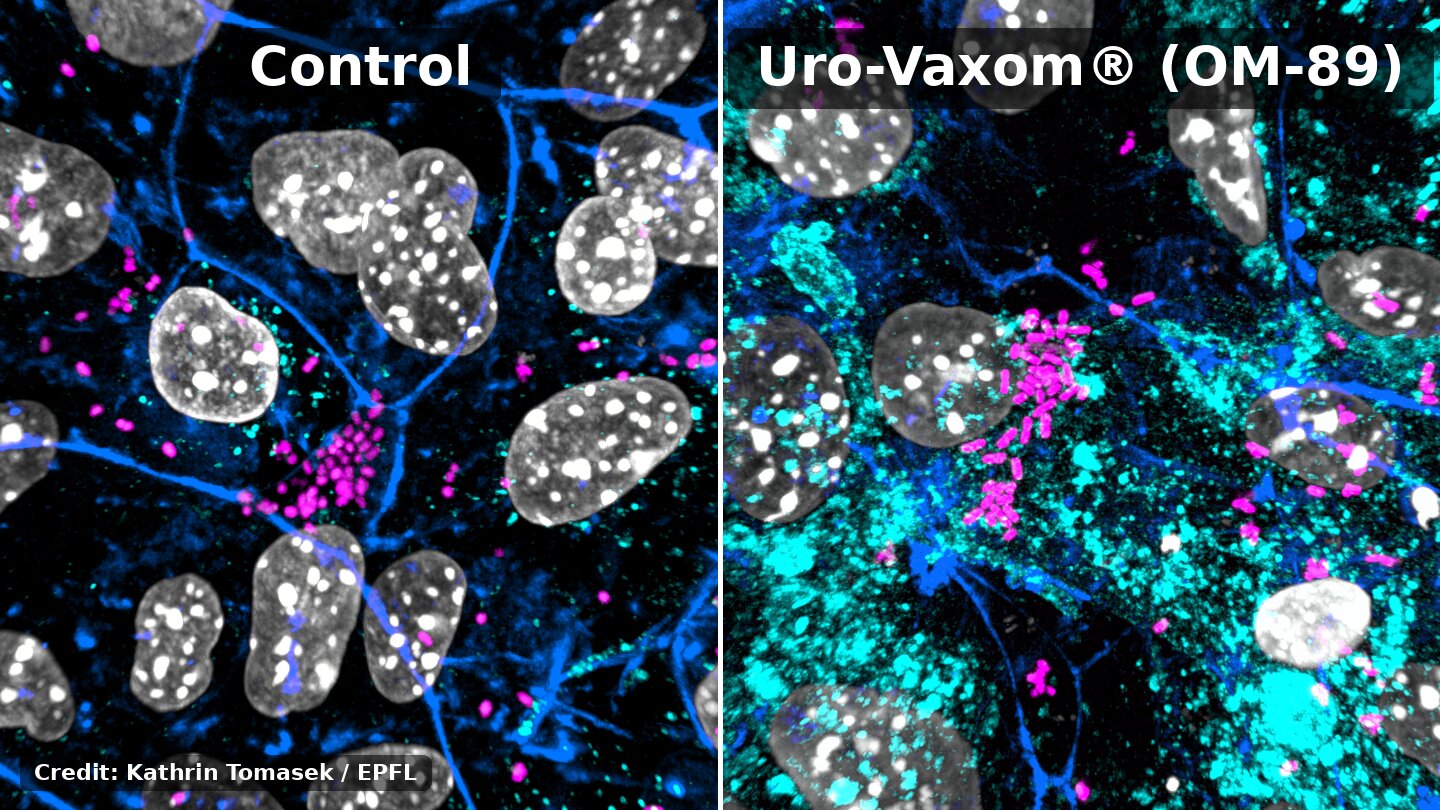 Hidden E. coli survive in bladder cells, but existing drug helps antibiotics reach them in lab tests