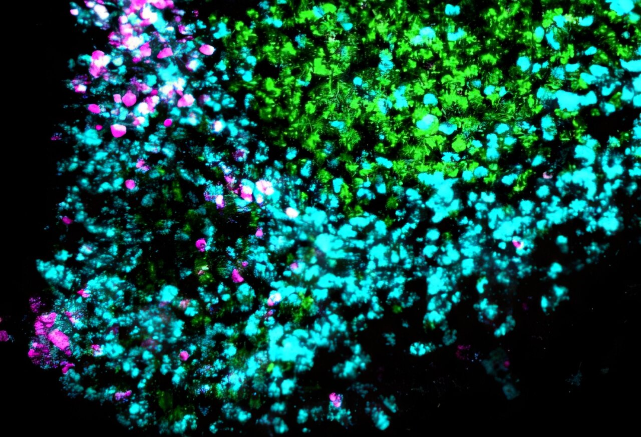 Newfound brain circuit coordinates eating and energy burning when temperatures drop