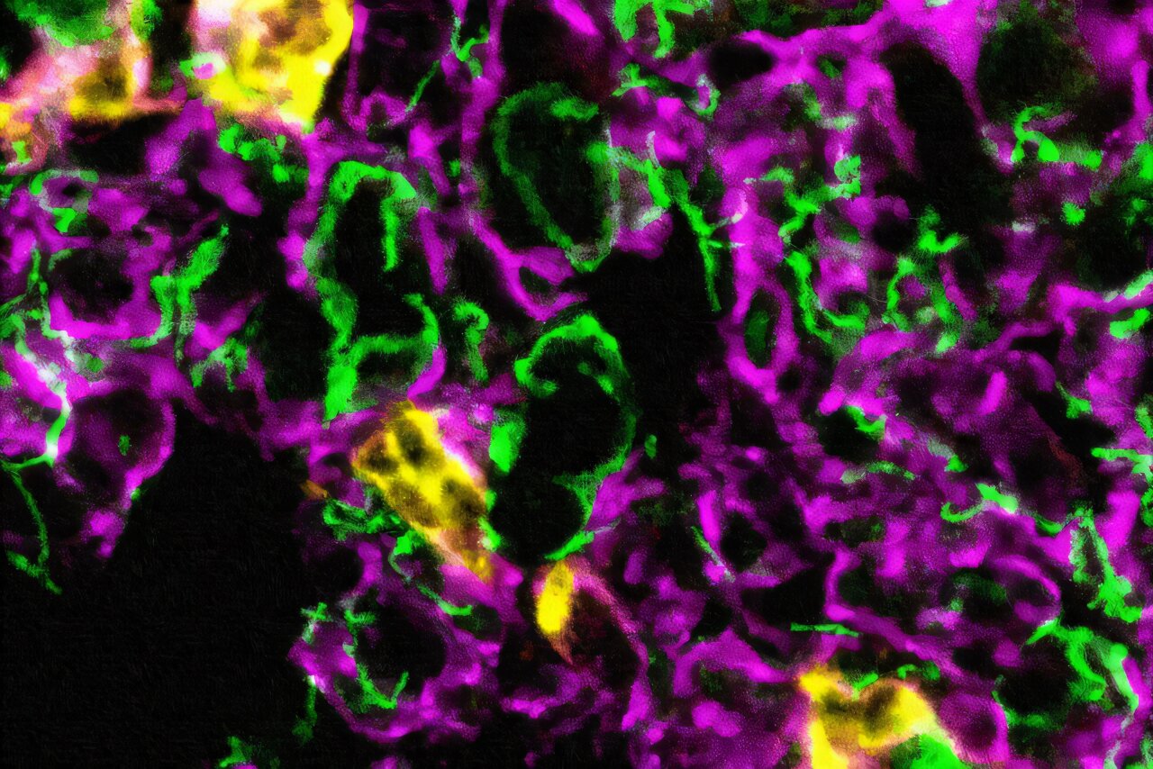 How blood vessels distinguish between growth and inflammation