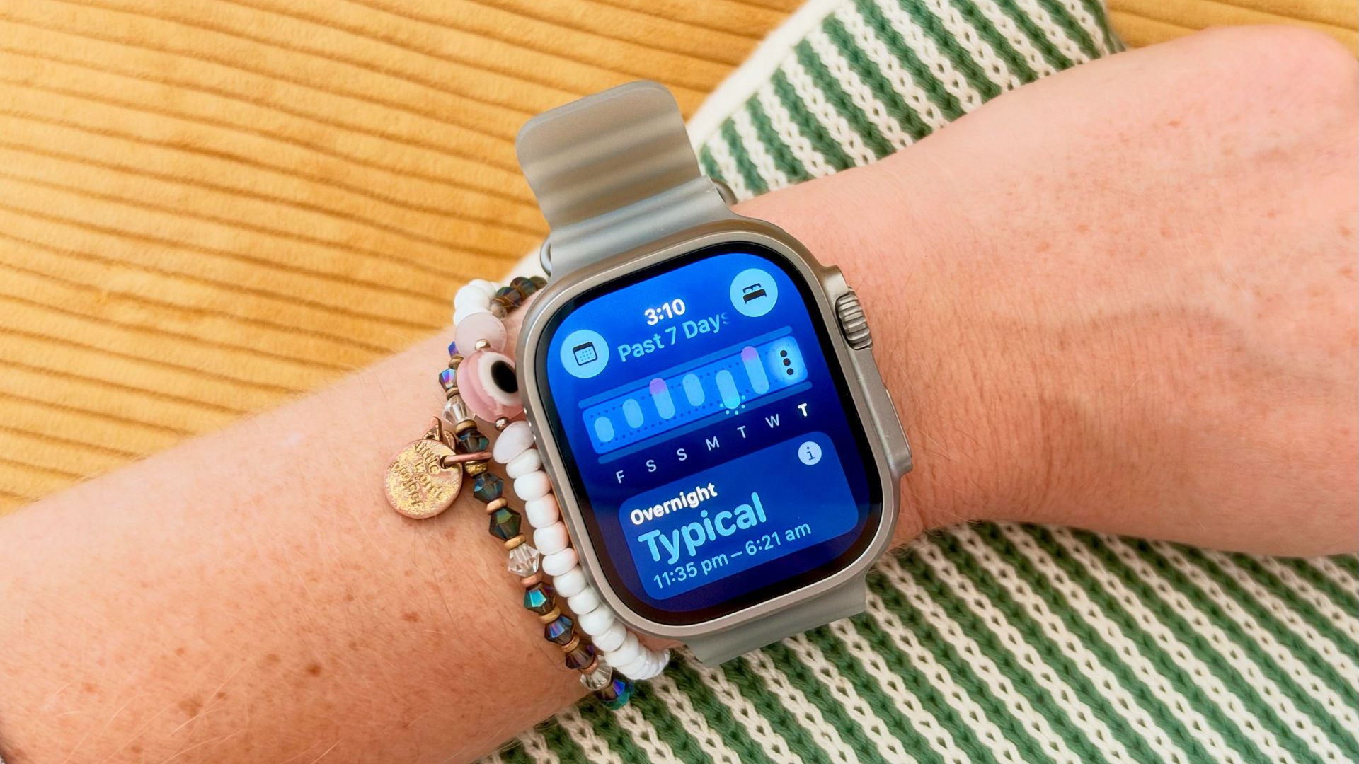 My Apple Watch spotted I was getting sick before I did this week — here's how to make the Vitals app more accurate