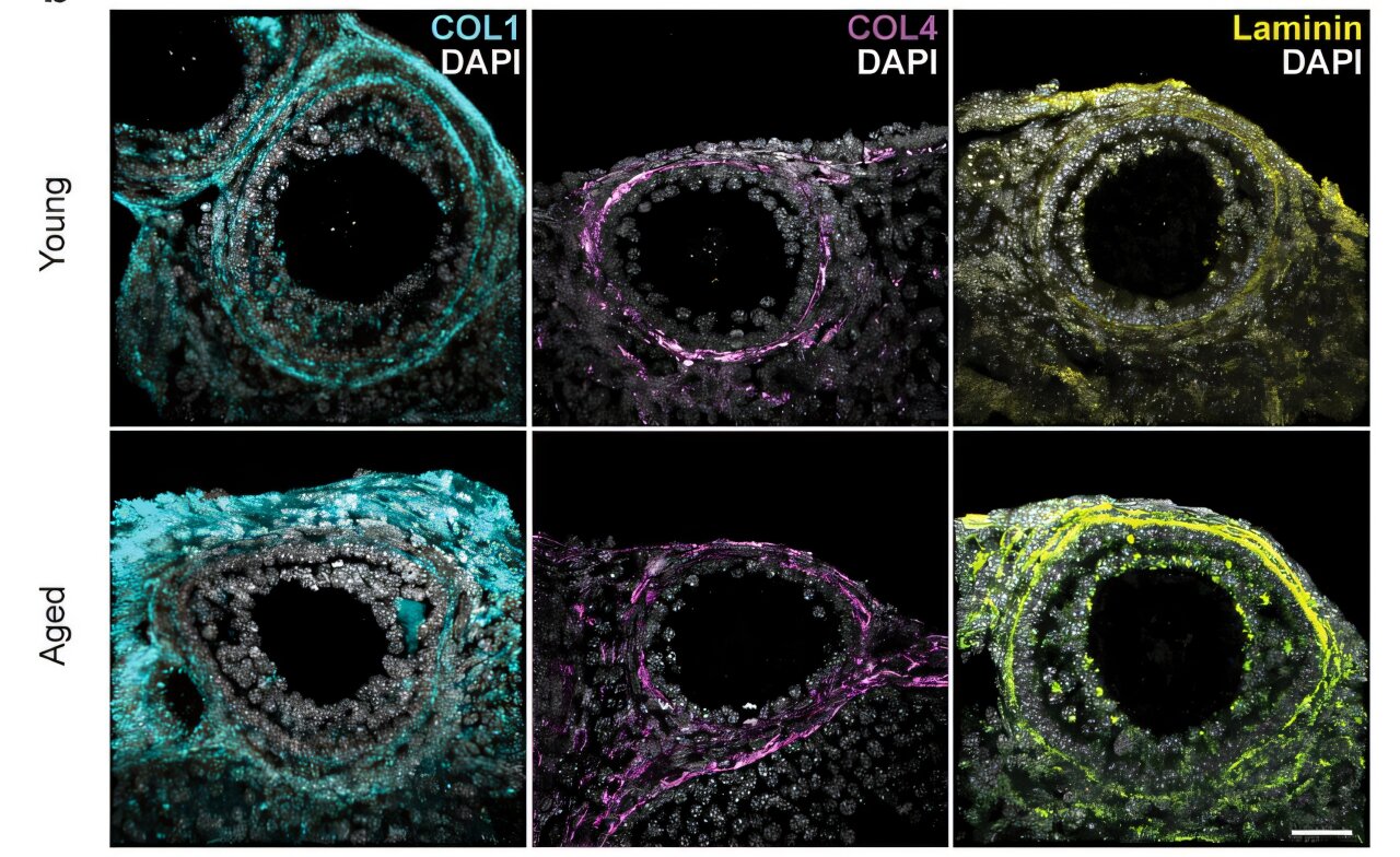Stiffer ovarian tissue disrupts cellular connections needed for egg development, lab experiments reveal