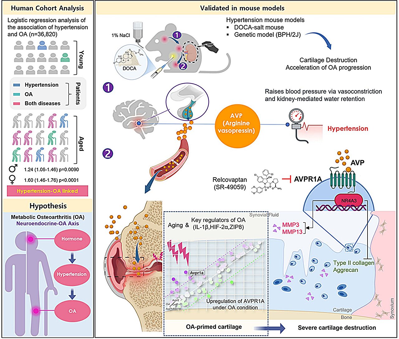 High blood pressure can accelerate osteoarthritis joint damage via a newly identified hormone pathway
