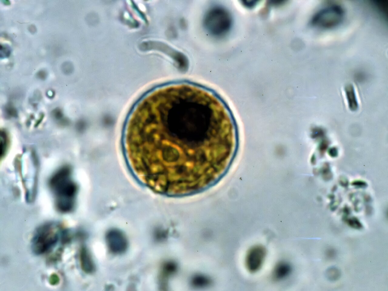 How pond algae led to a Nobel prize and a new way to study the brain