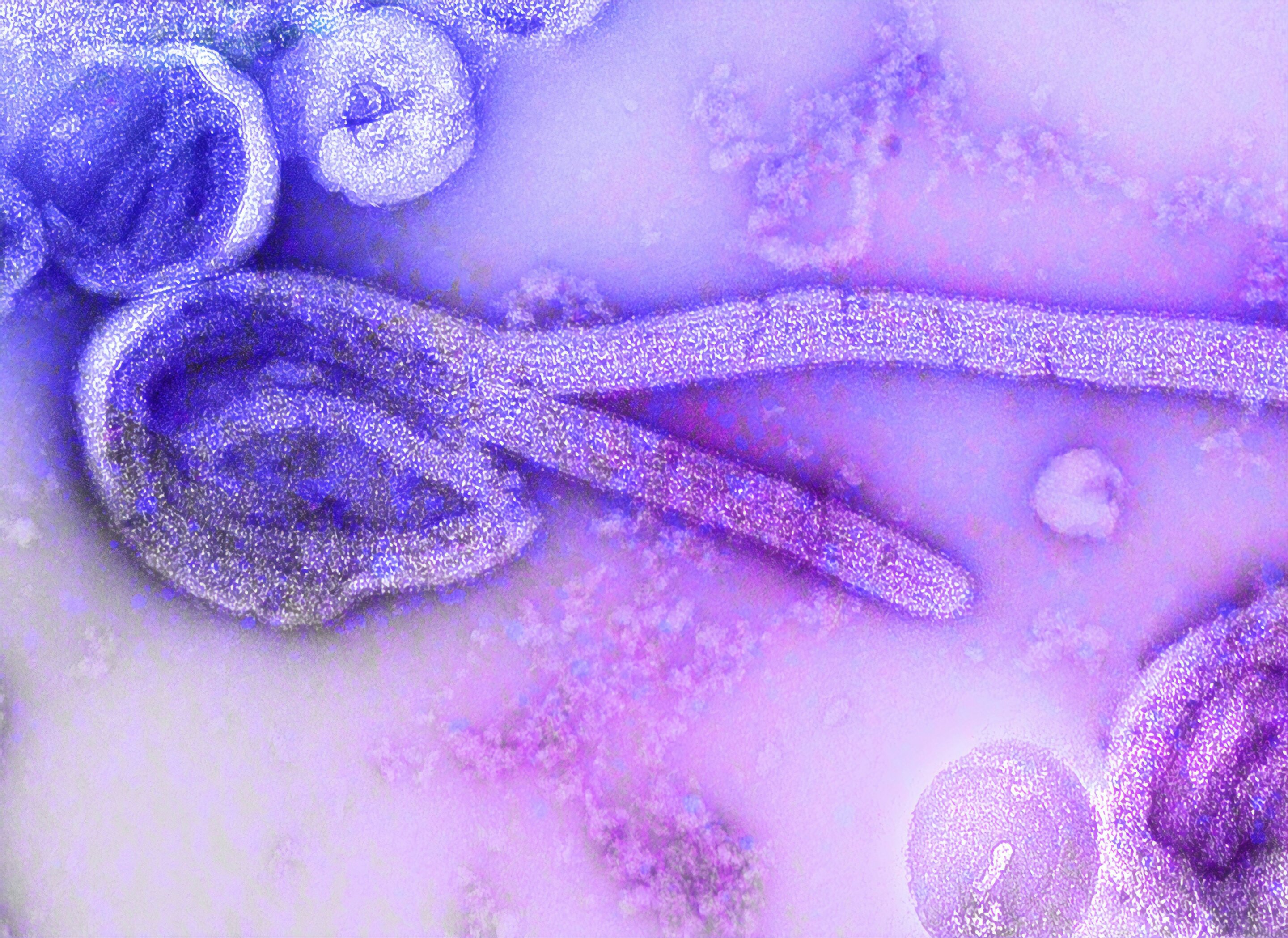 Kenya reports first-ever Ebola death