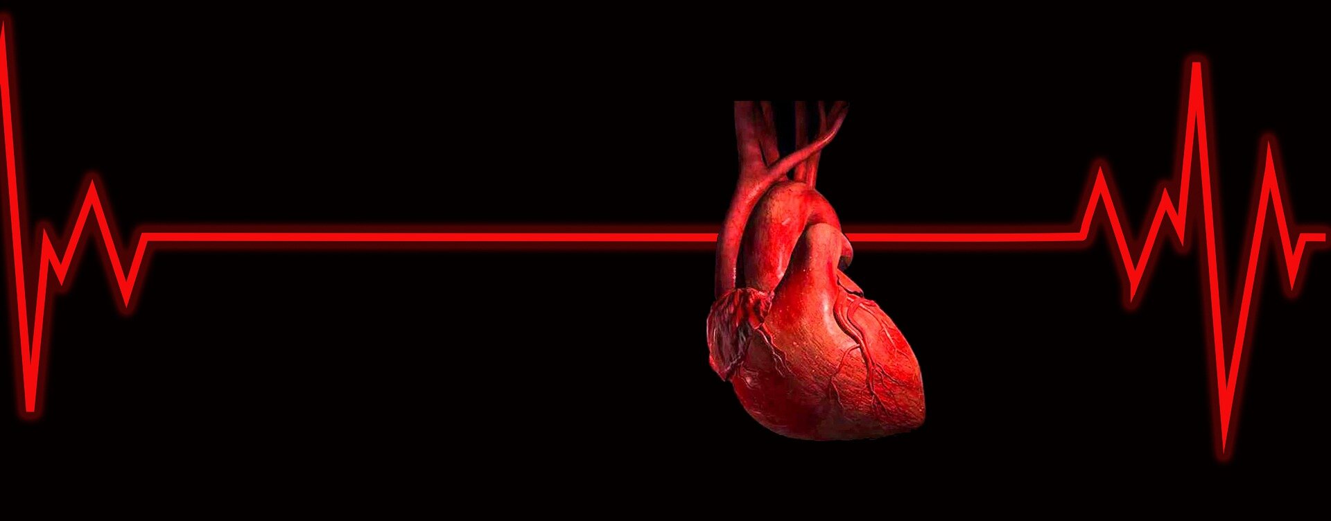 Digital alerts support timely treatment decisions of critically ill cardiac patients