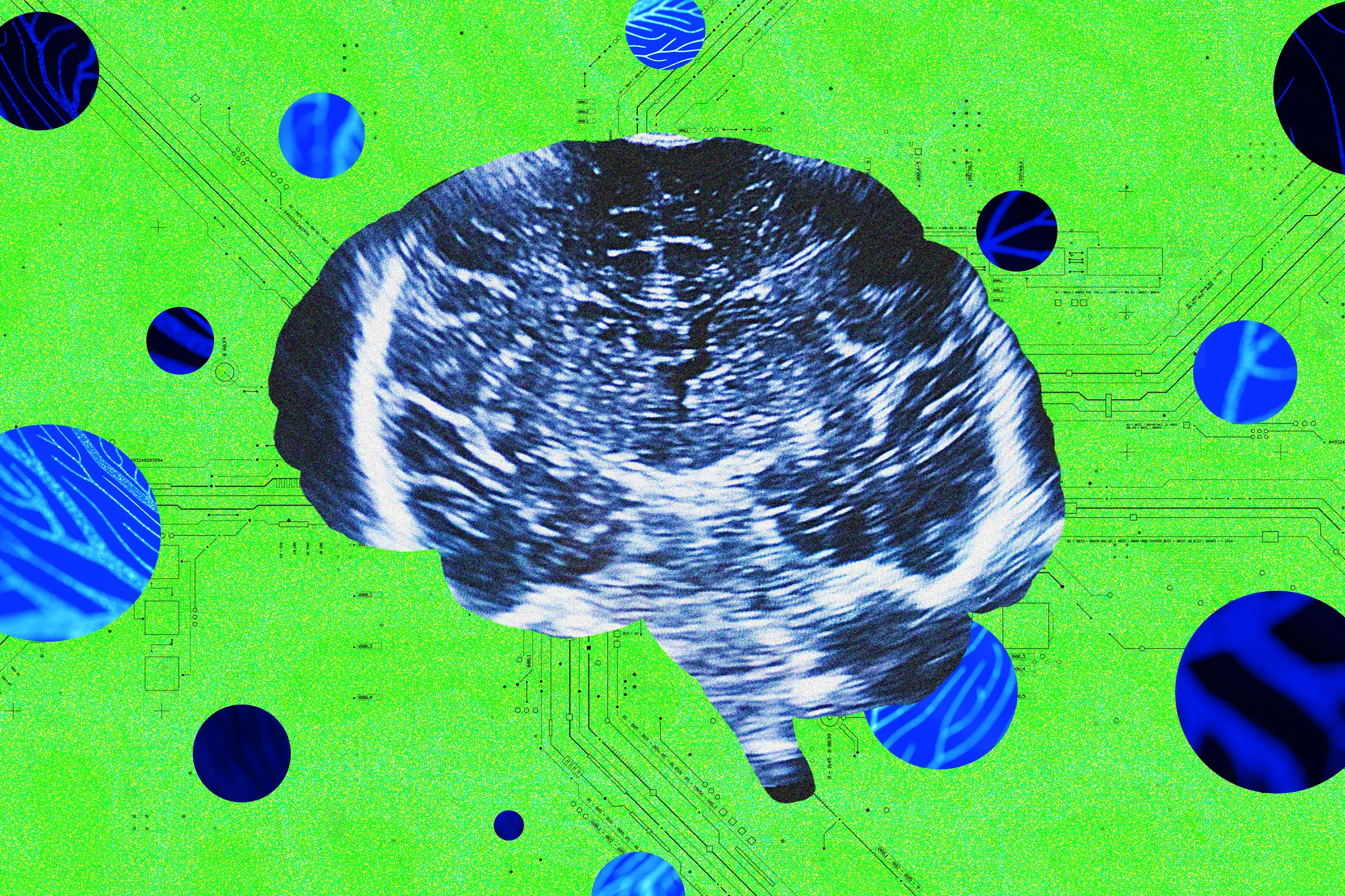 A New Neurotech Startup Launches to Rival Sam Altman’s Merge Labs