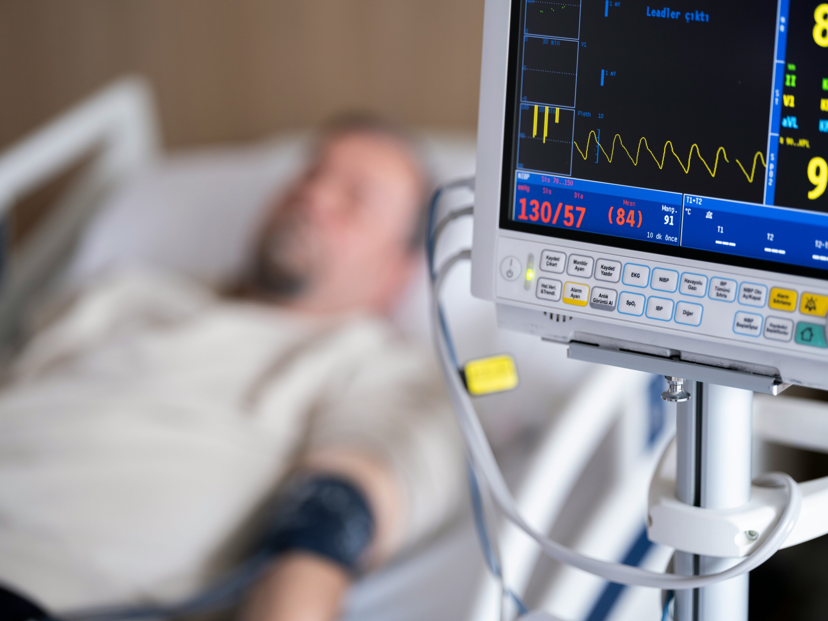 AI may help catch heart transplant rejection without biopsies