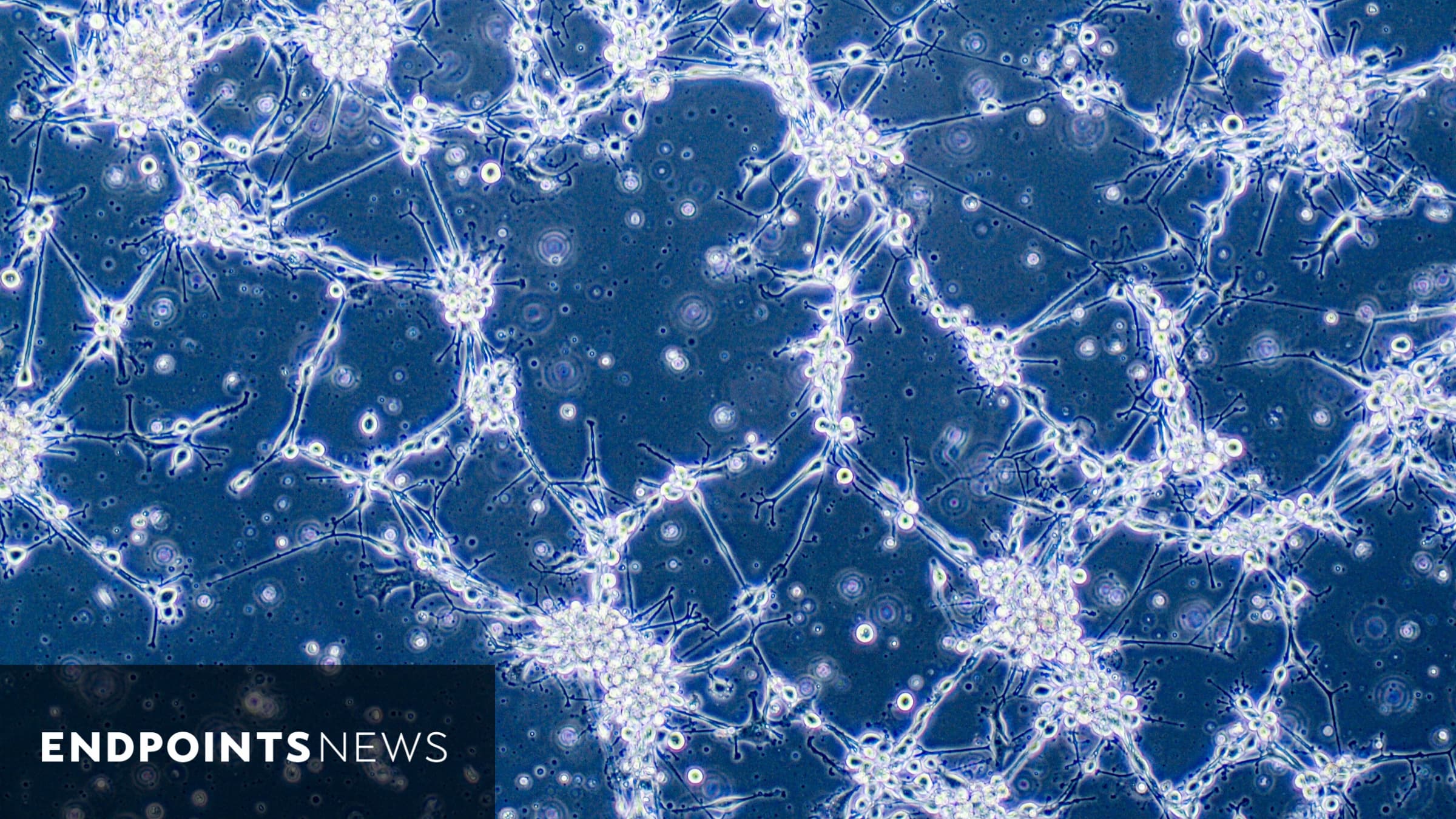 MimiVax's cancer vaccine for glioblastoma narrowly misses Phase 2b goal