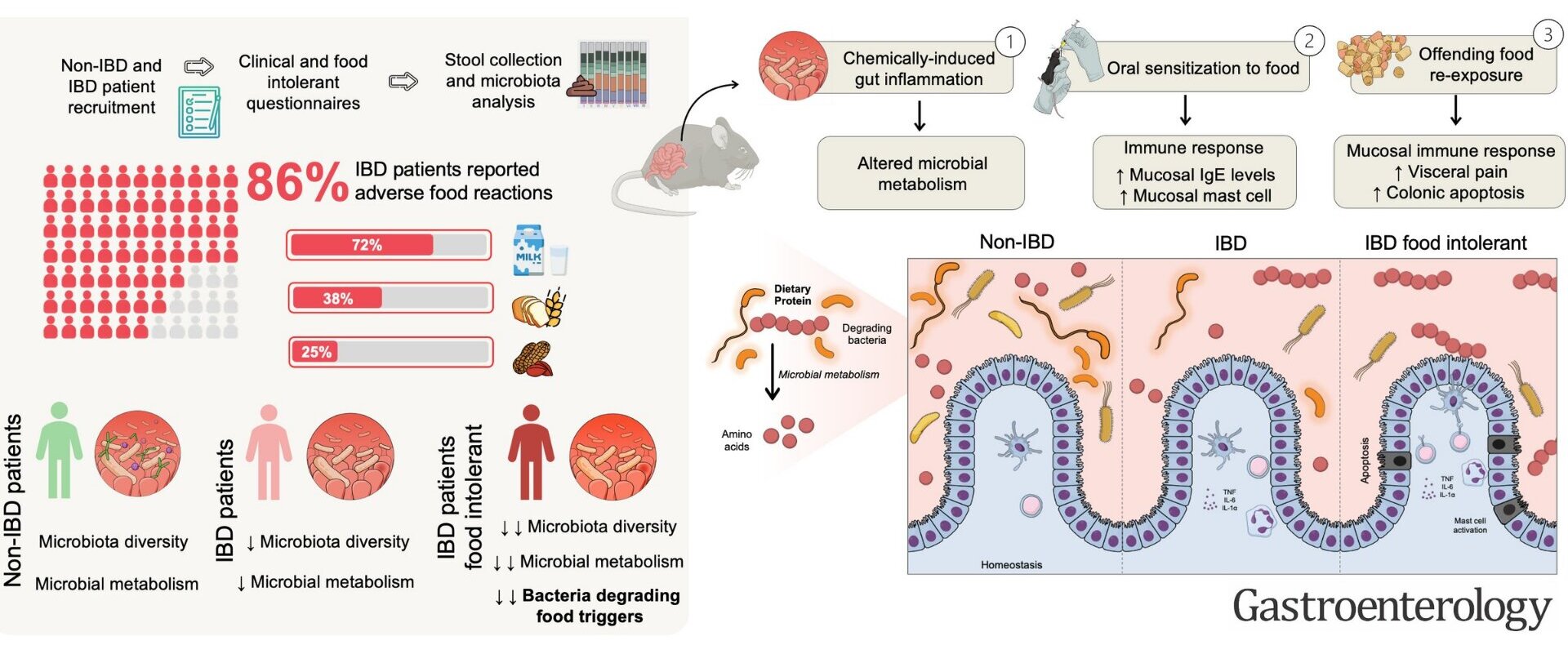 Study may explain why IBD patients react to foods they once tolerated