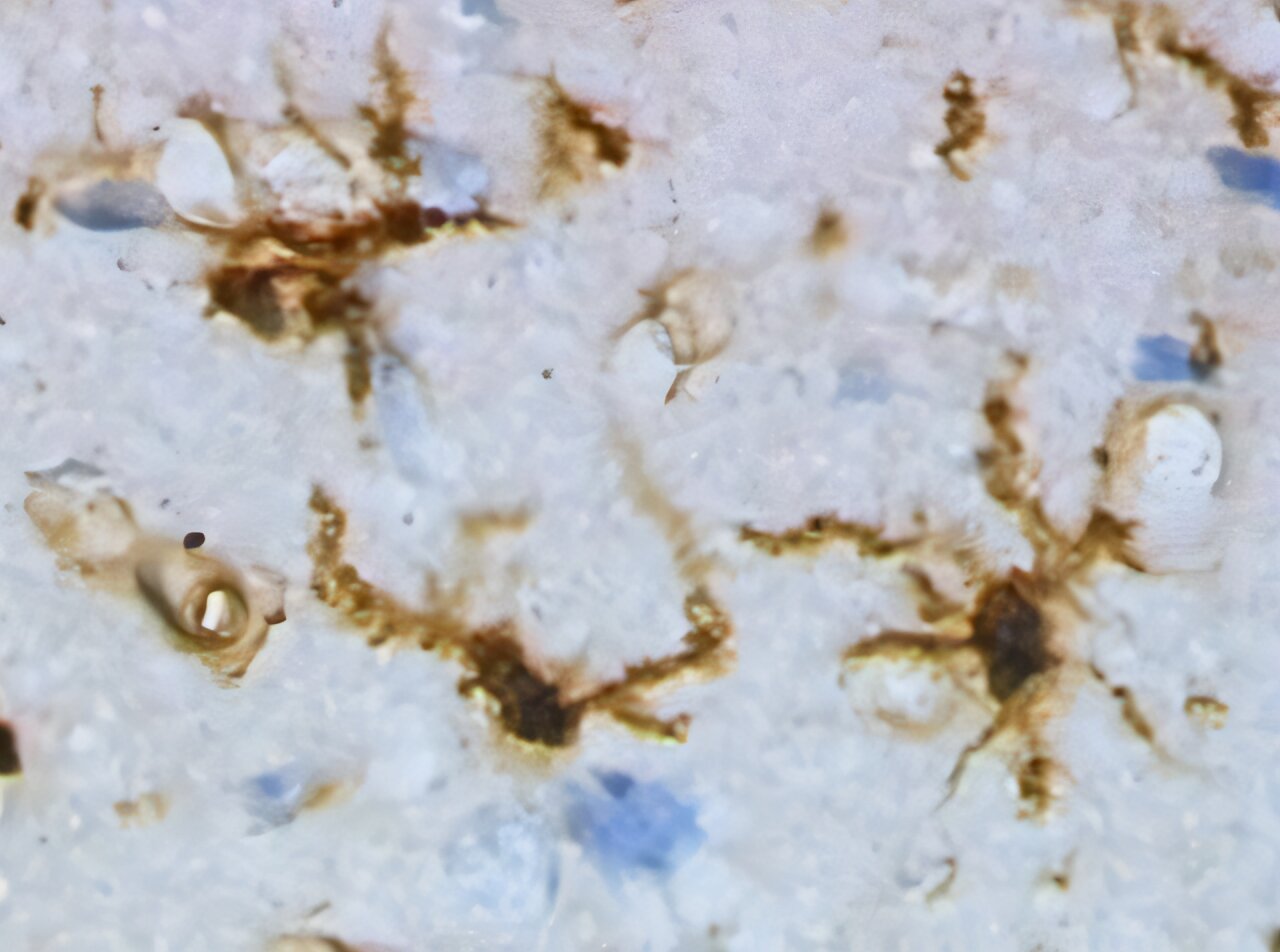 Brain immune cells protect neurons in Parkinson's disease by 'nibbling' harmful material