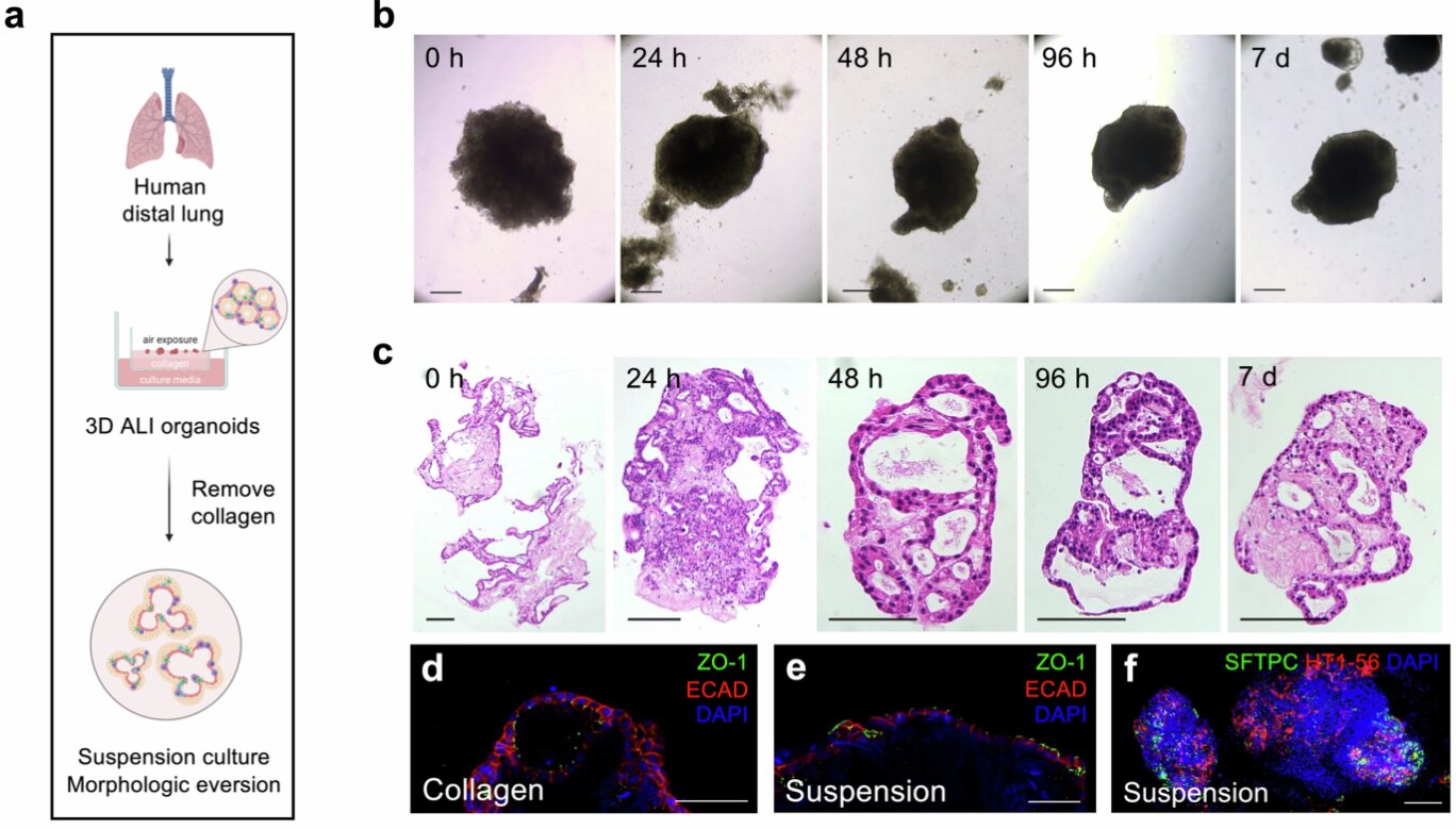 Human lung organoids with a built-in immune system could transform respiratory disease research