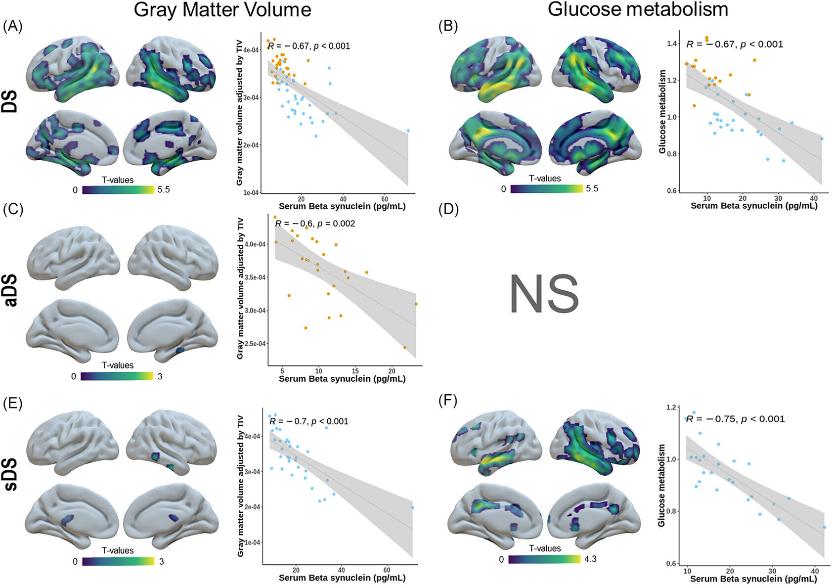Blood marker may flag Alzheimer's-related changes in Down syndrome decades before symptoms appear