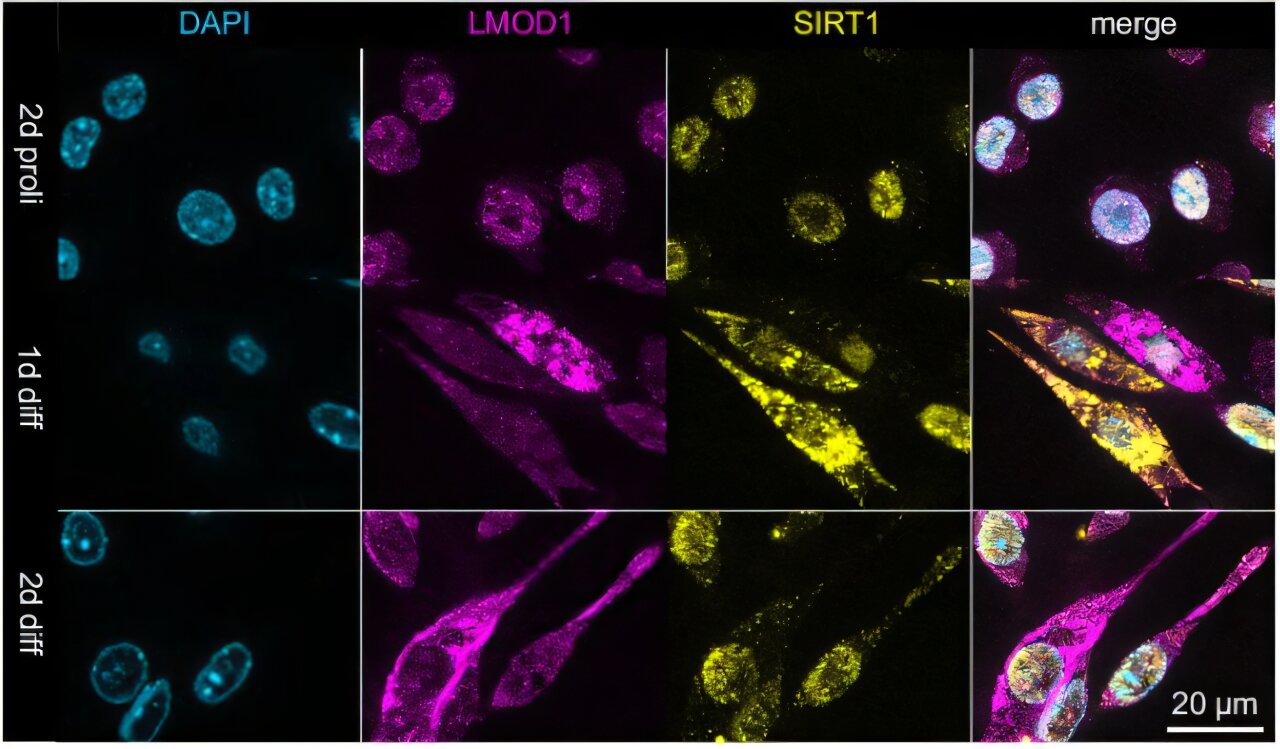 Protein LMOD1 offers new clues to muscle regeneration