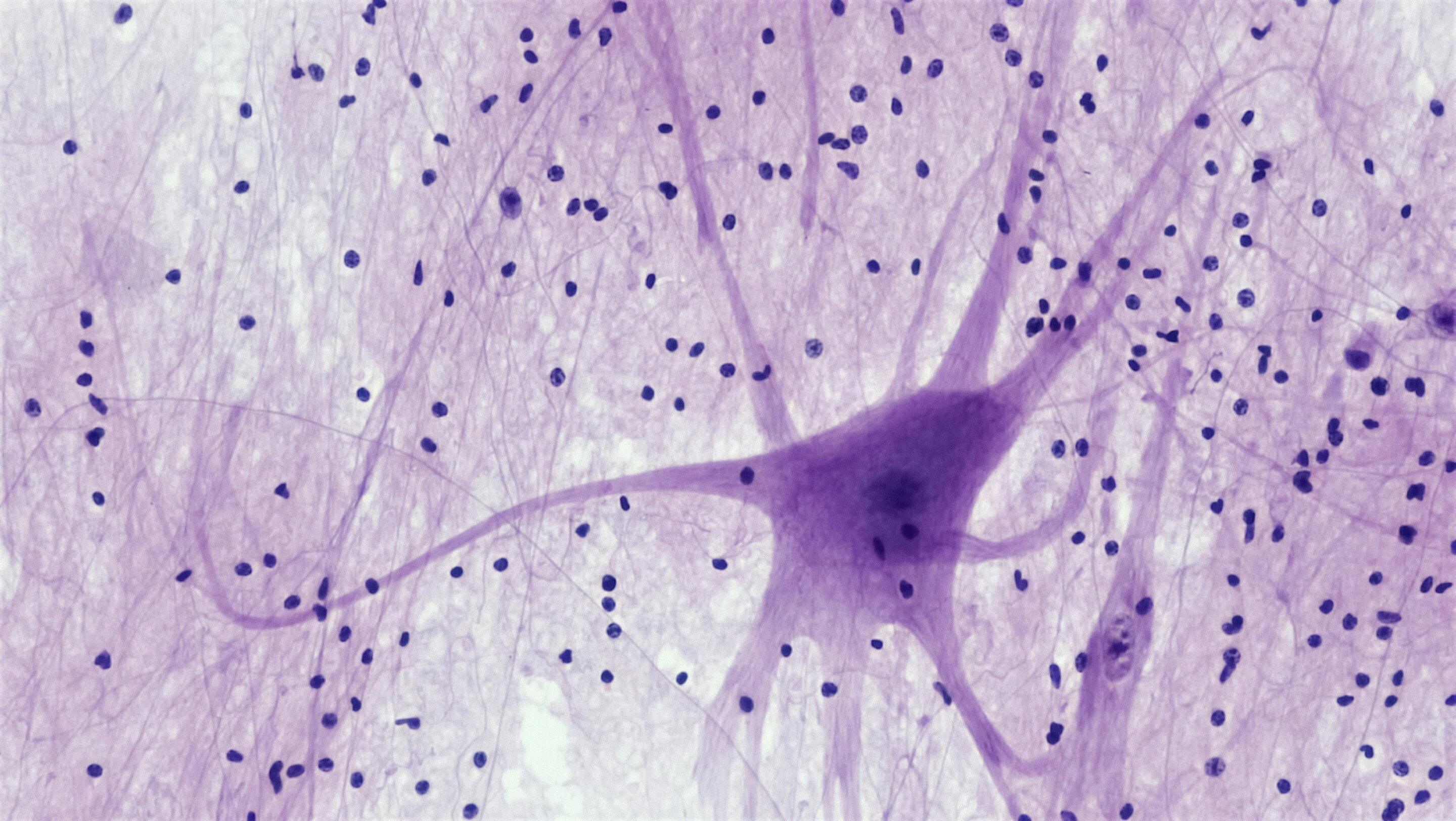 Fruit fly study reveals how neural gates switch on short-term memory