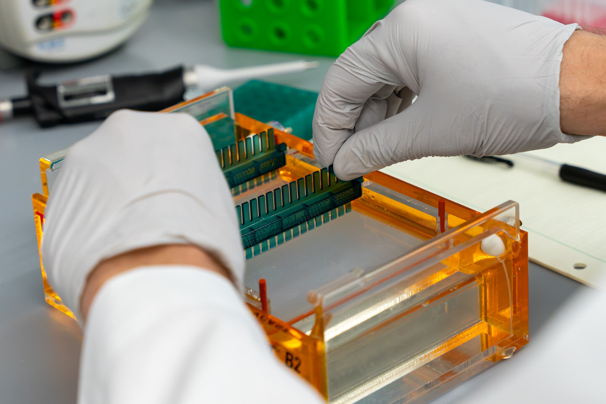 Fat-storing gene emerges as possible contributor to anorexia risk