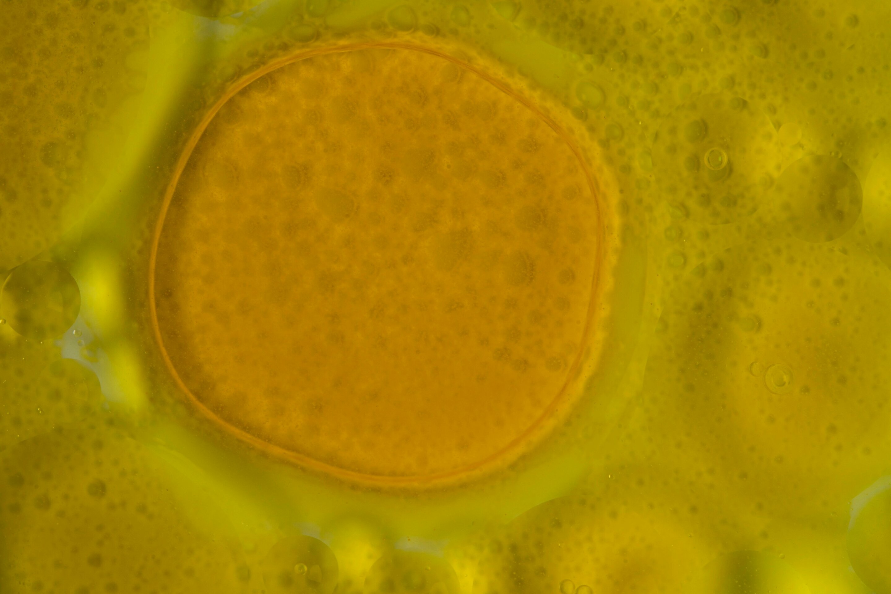 Rogue lipids: How routine cellular stress can fuel chronic inflammation