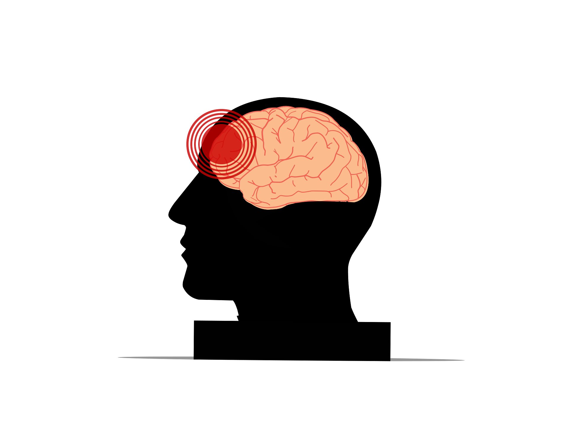 Traumatic brain injury can alter the brain's subsequent response to stress, study shows