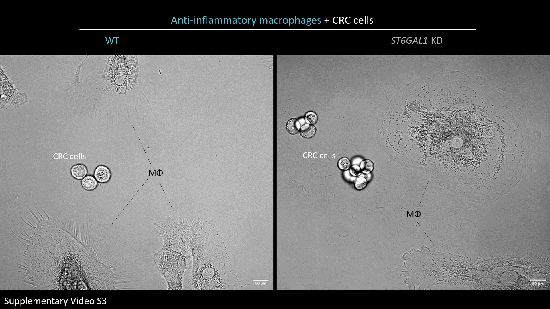 Shifting immune cells toward cancer-fighting mode: Sugar-coated extensions reveal a potential target