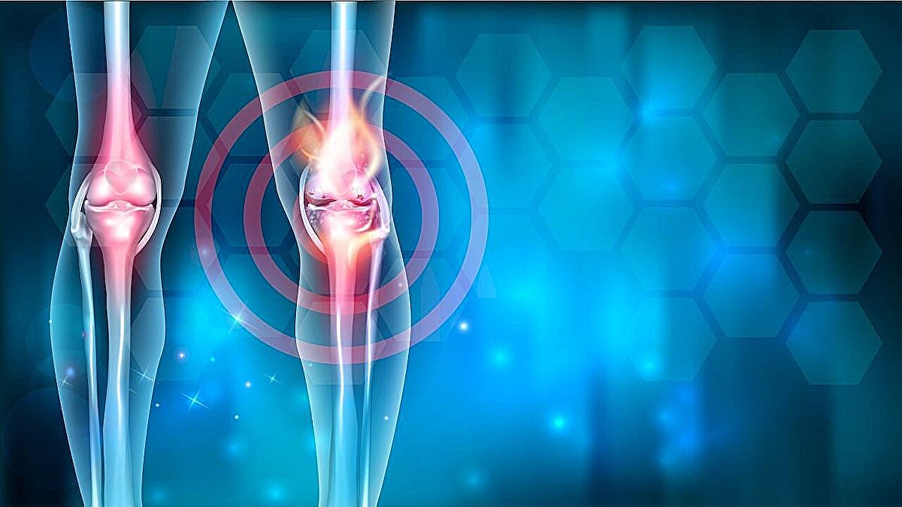 ASTRO: Low-dose radiotherapy shows potential in early knee osteoarthritis