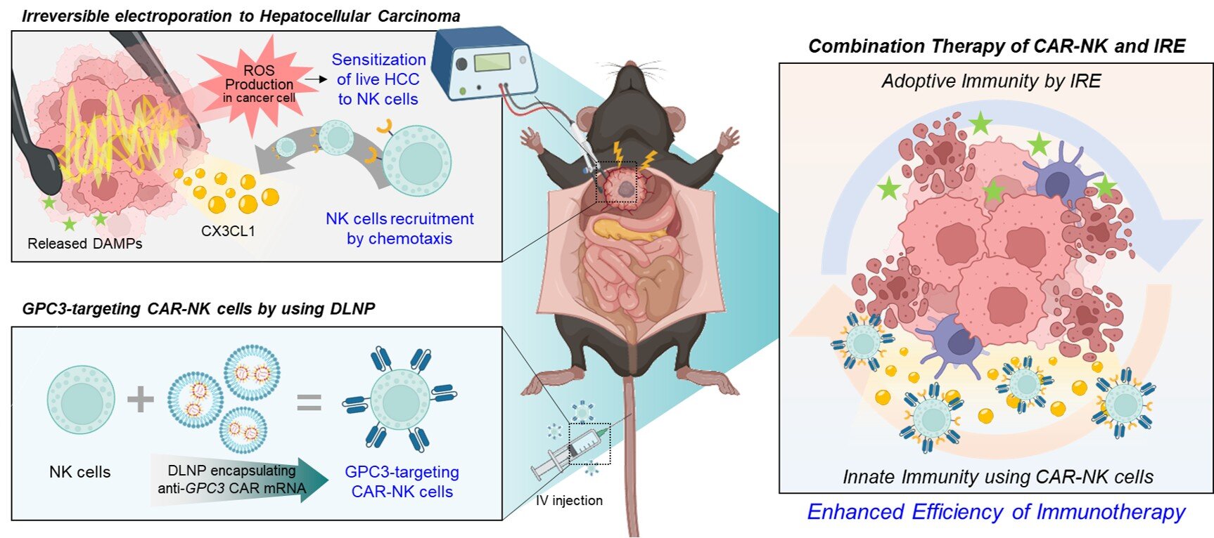 Electrical ablation boosts CAR-NK cell therapy against liver cancer, offering new strategy for refractory solid tumors