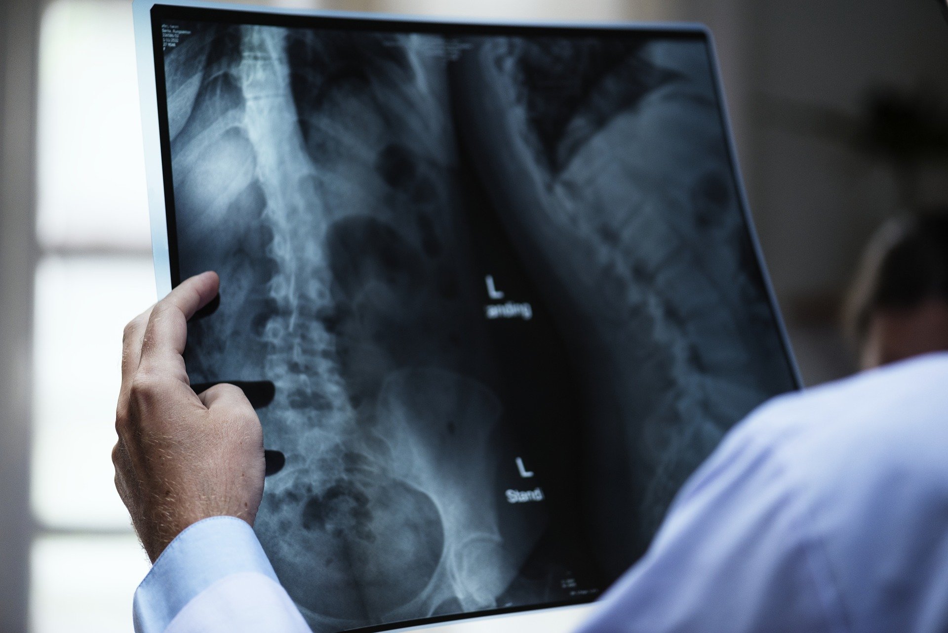 Does a bone tumor always mean cancer?