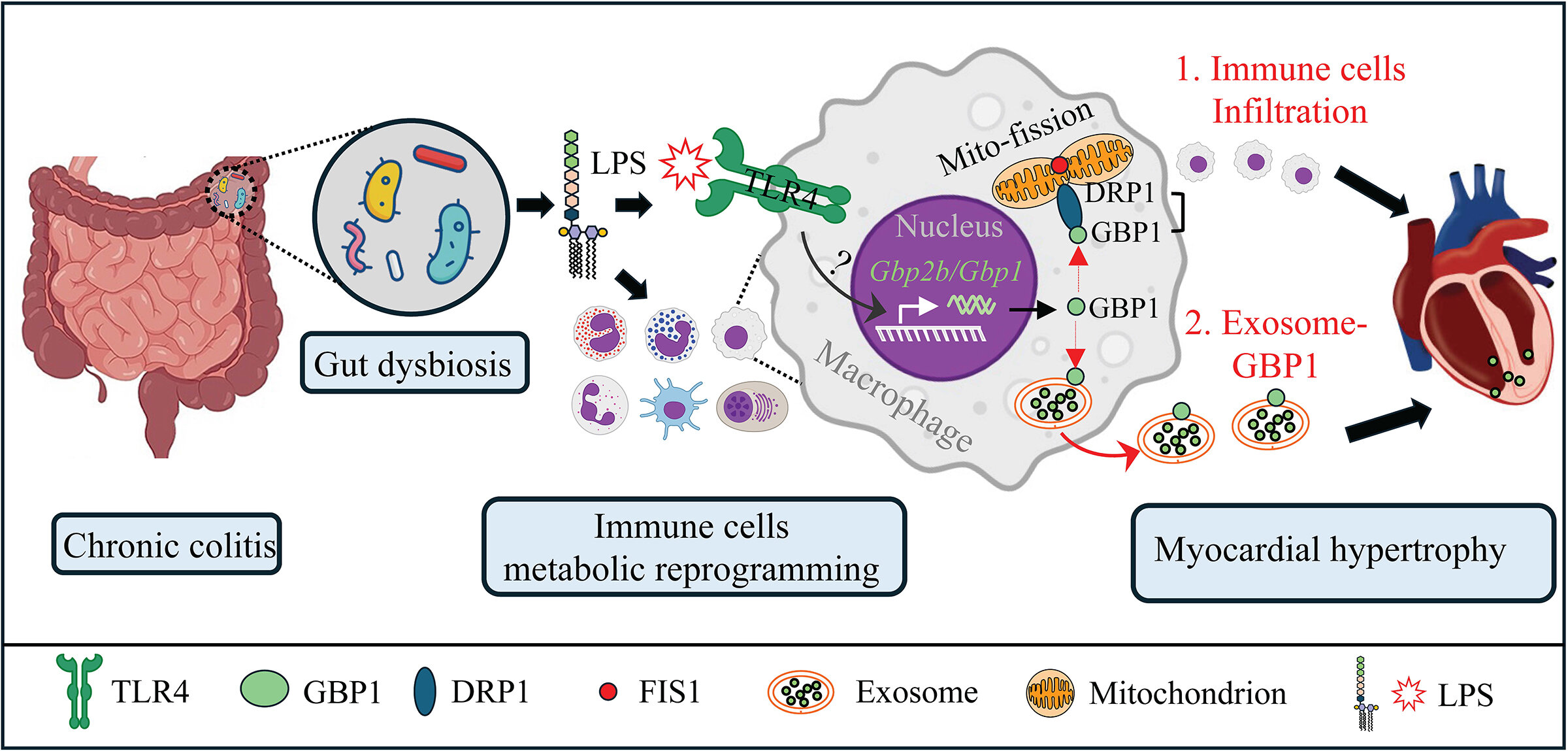 Chronic intestinal inflammation can affect heart through changes in gut microbiota and immune cells, study finds