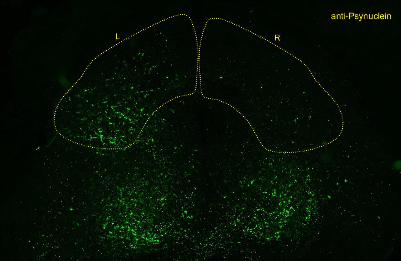 Increasing protective protein suppresses Parkinson's-linked buildup, more than doubling lifespan in mouse model