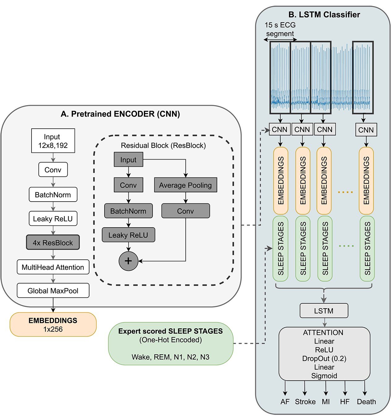 Deep learning model using ECGs during sleep studies can predict cardiovascular outcomes