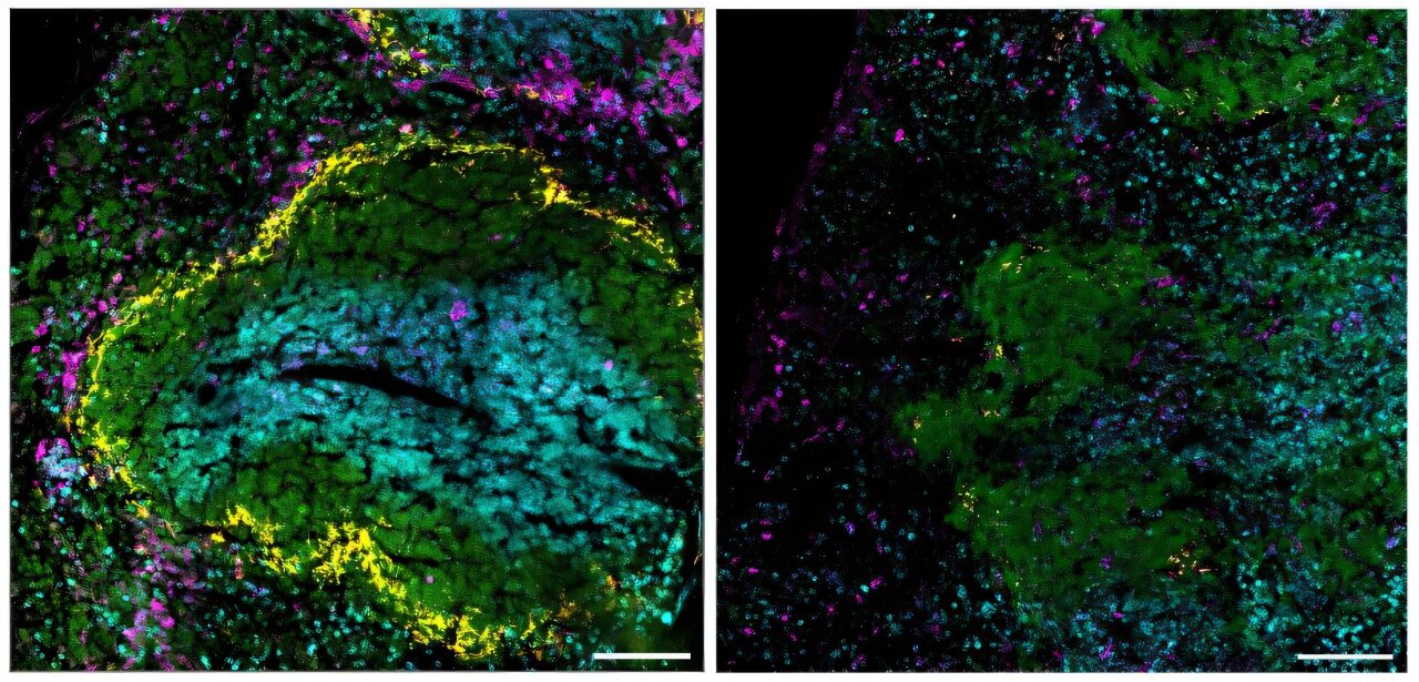 How the benefits of vaccination extend beyond protection from infection