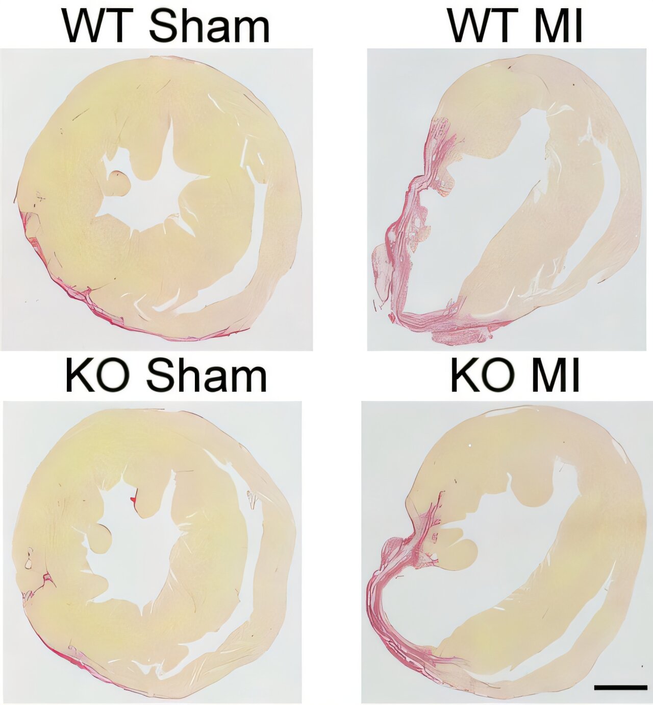 Enzyme inhibitor limits scarring after heart attacks and protects heart function in mice