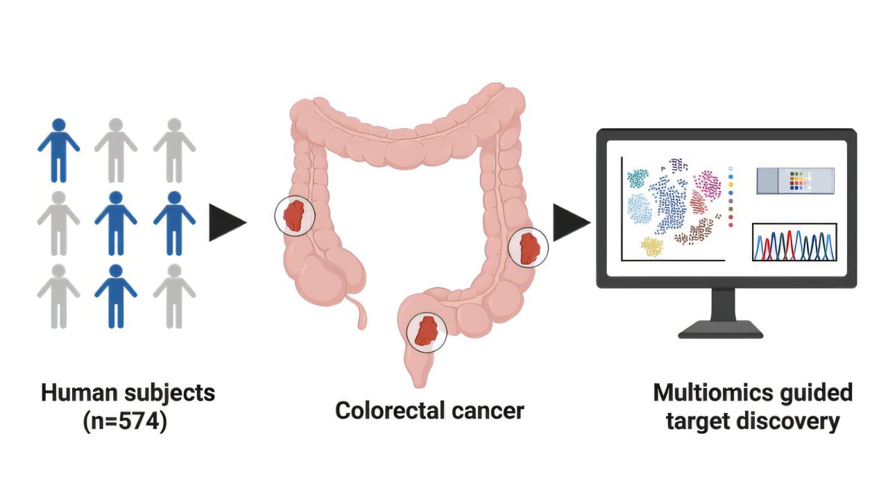 Tracking molecular malfunctions in metastatic colorectal cancer to find new avenues for treatment