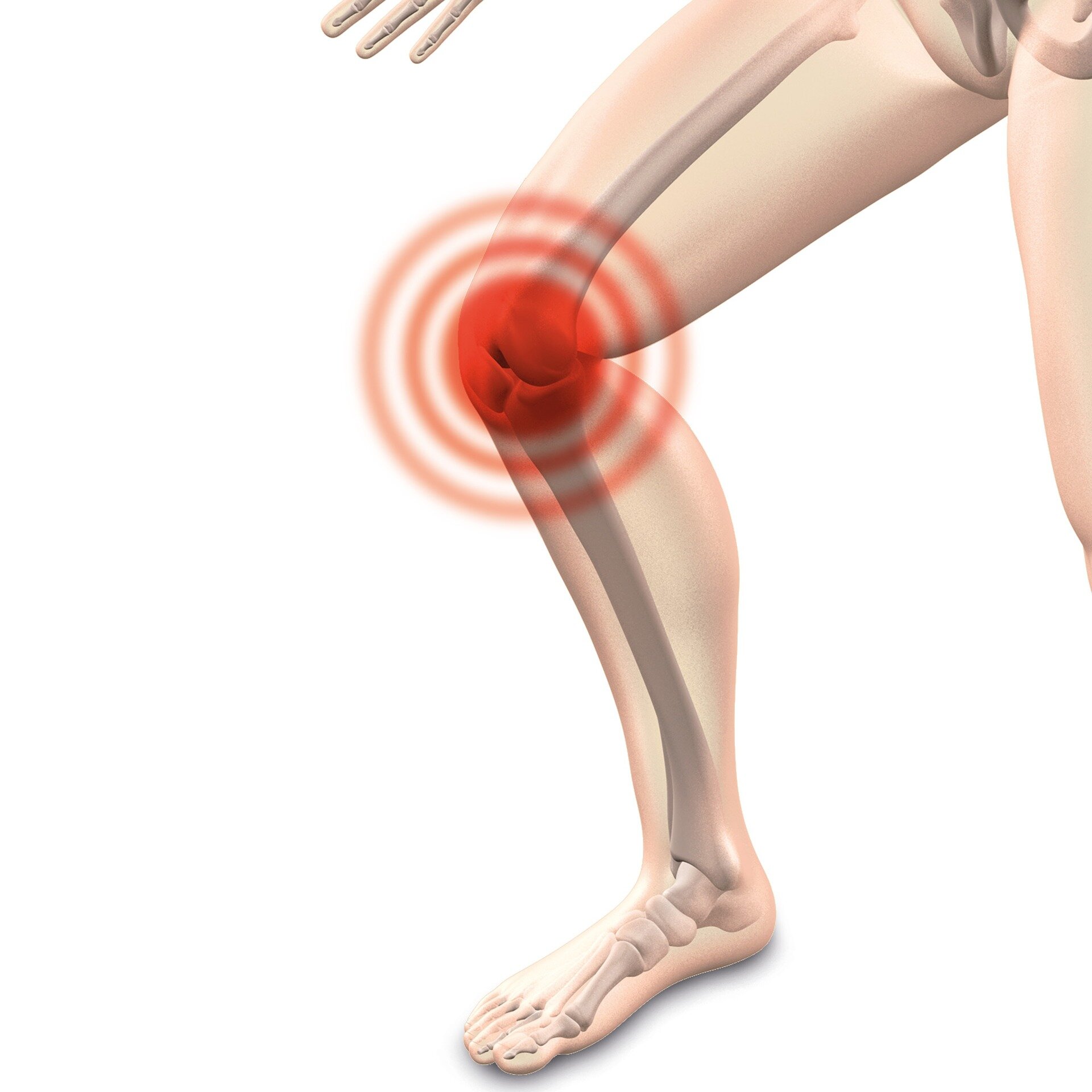 Nearly one billion people could live with osteoarthritis by 2050, international experts warn
