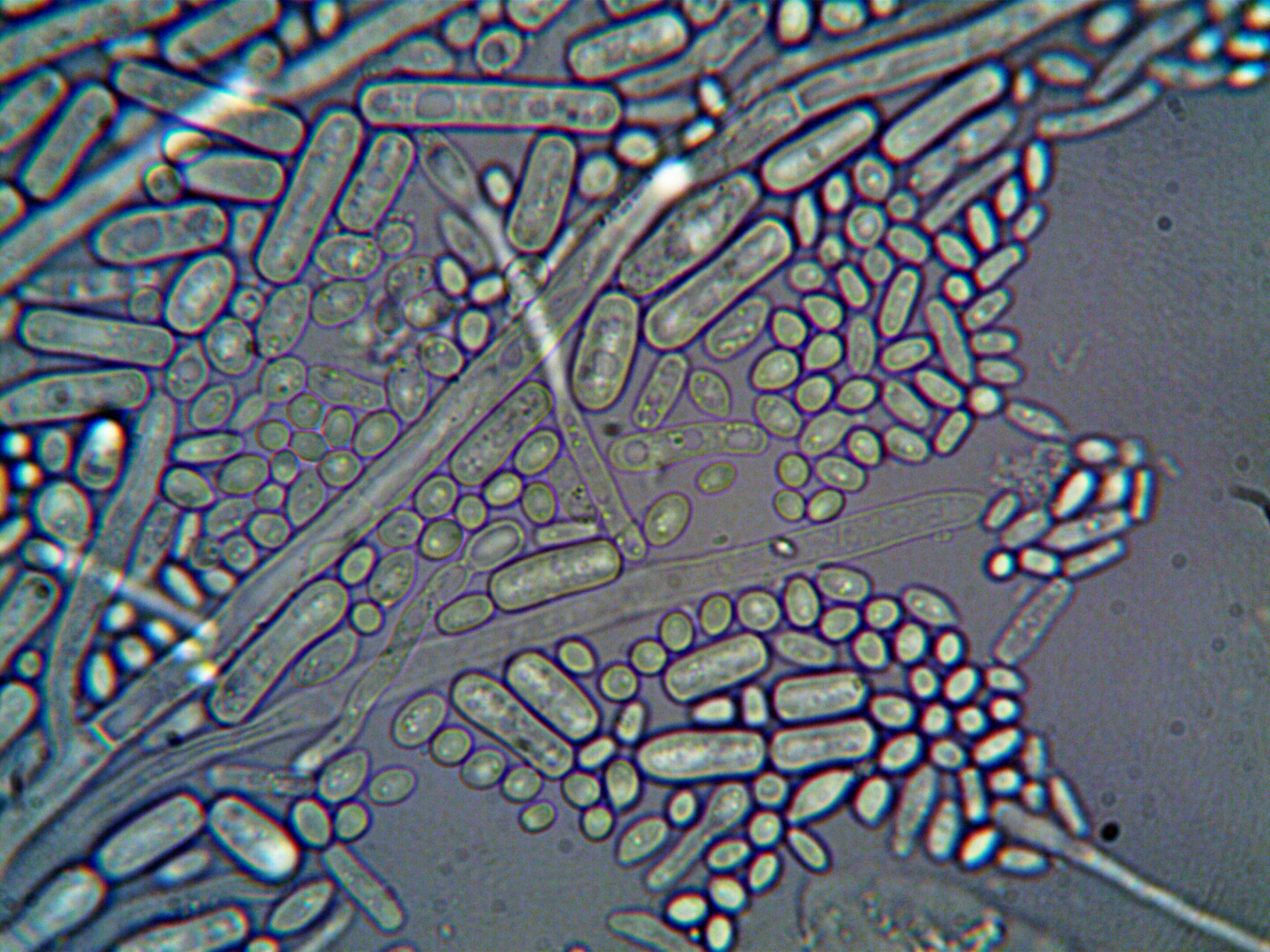 Early gut microbes help the newborn immune system fight deadly infections, mouse experiments suggest