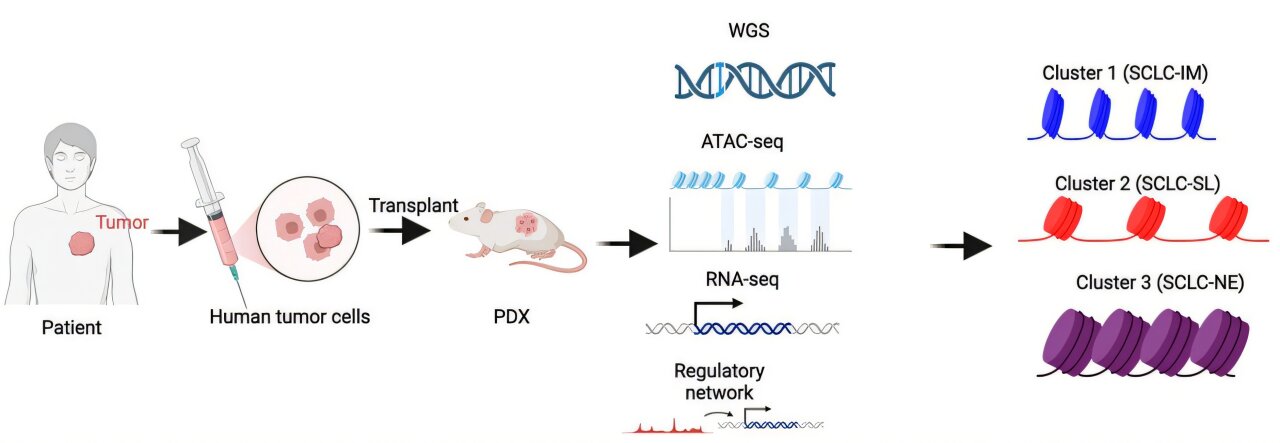 Stem cell–like tumor state may help identify high-risk small-cell lung cancer