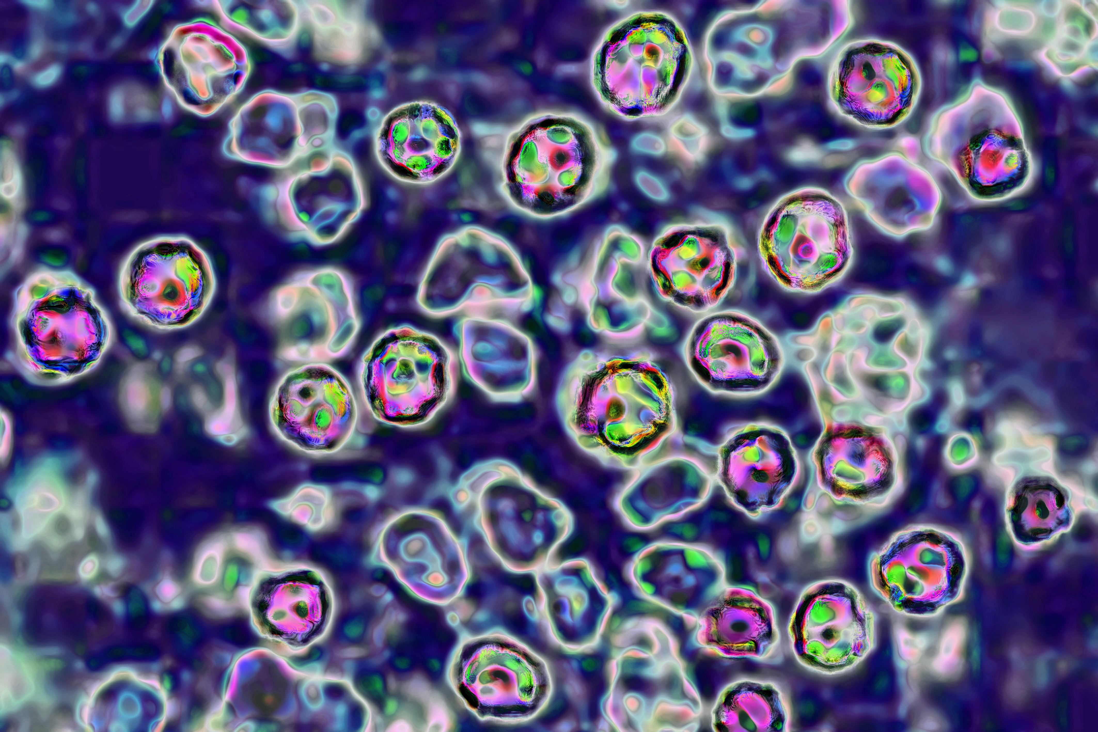 39-year-old unvaccinated woman becomes 6th measles death in Pennsylvania