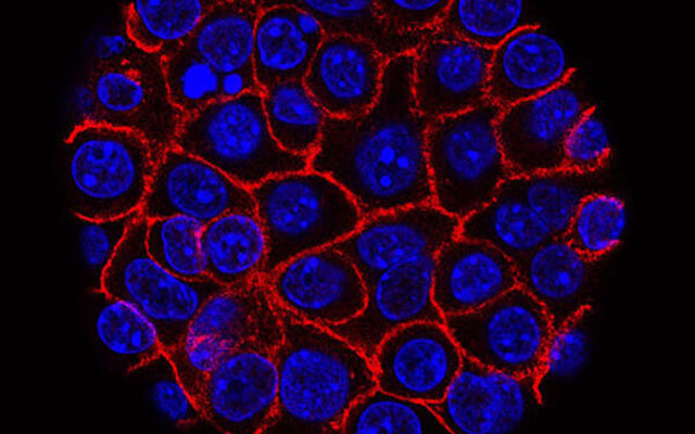 Continuously evolving cells help pancreatic cancer evade treatment and spread