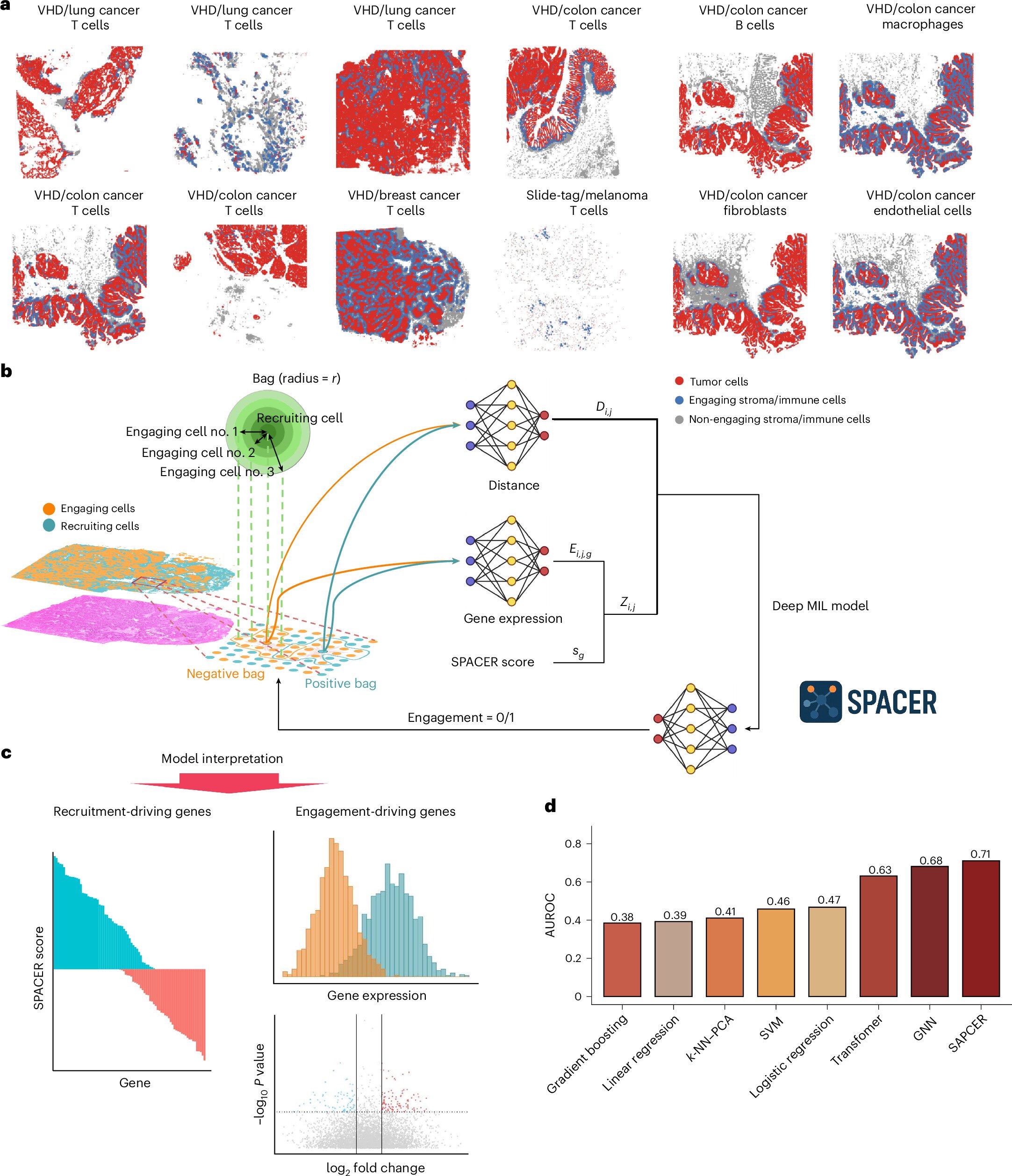 AI tool reveals what attracts immune cells to tumors and what keeps them away